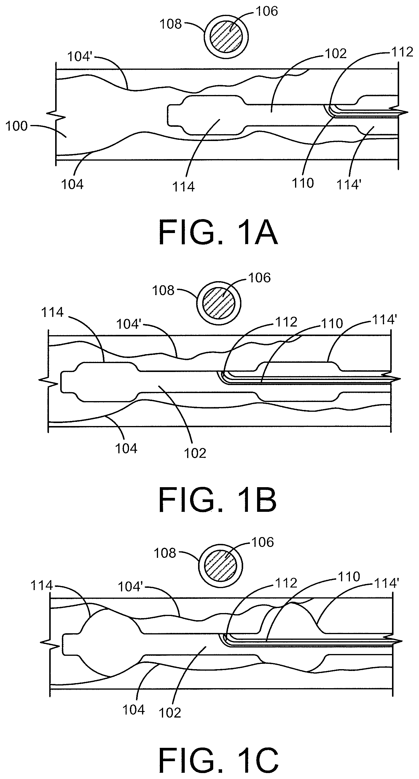 Patent US12496469 — Devices and methods for endoluminal delivery of either fluid or energy for denervation — Figure 1