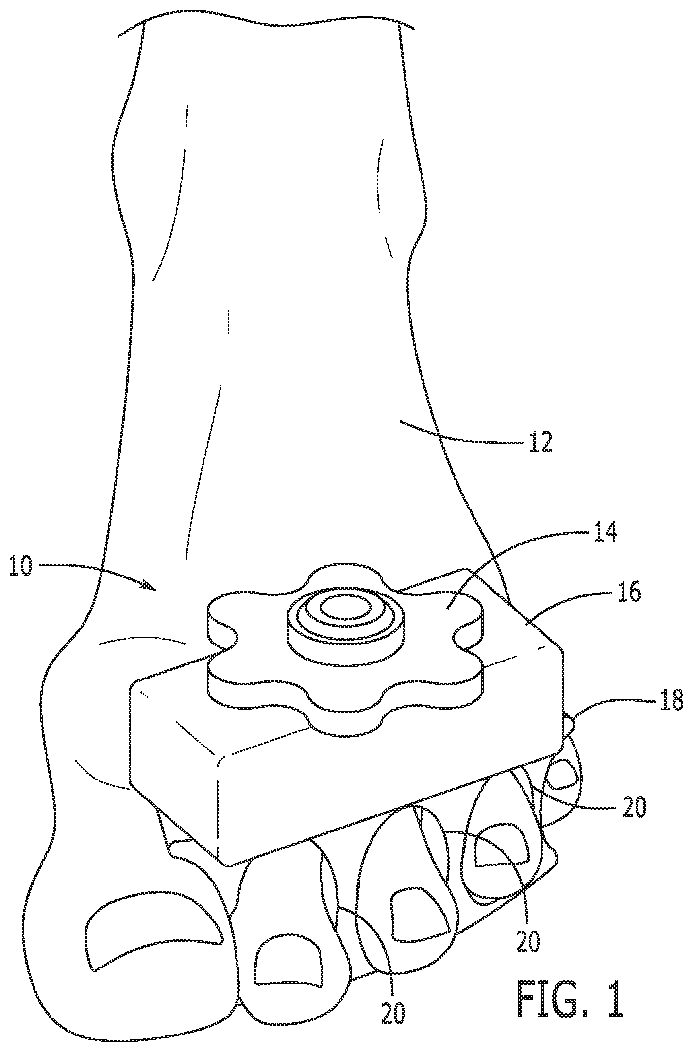 Patent US12496485 — Fitness device for lower body — Figure 1