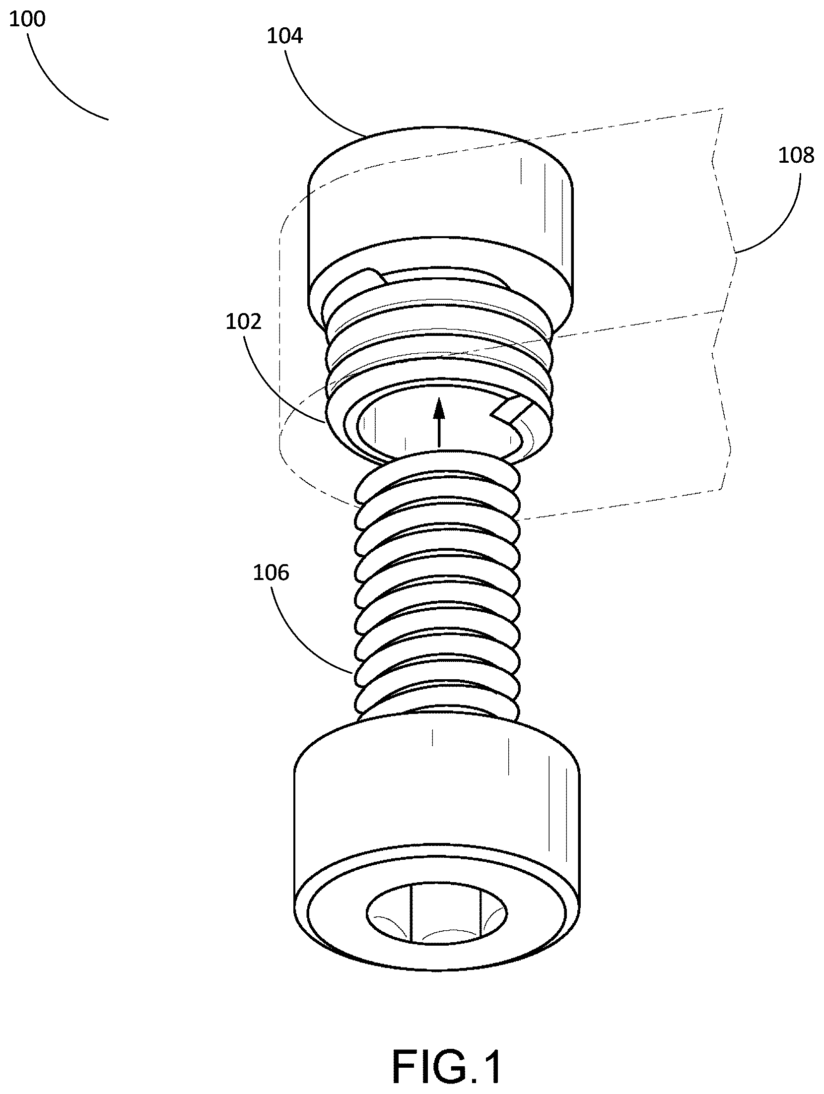 Patent US12504034 — Fastening system using an axially magnetized threaded insert — Figure 1
