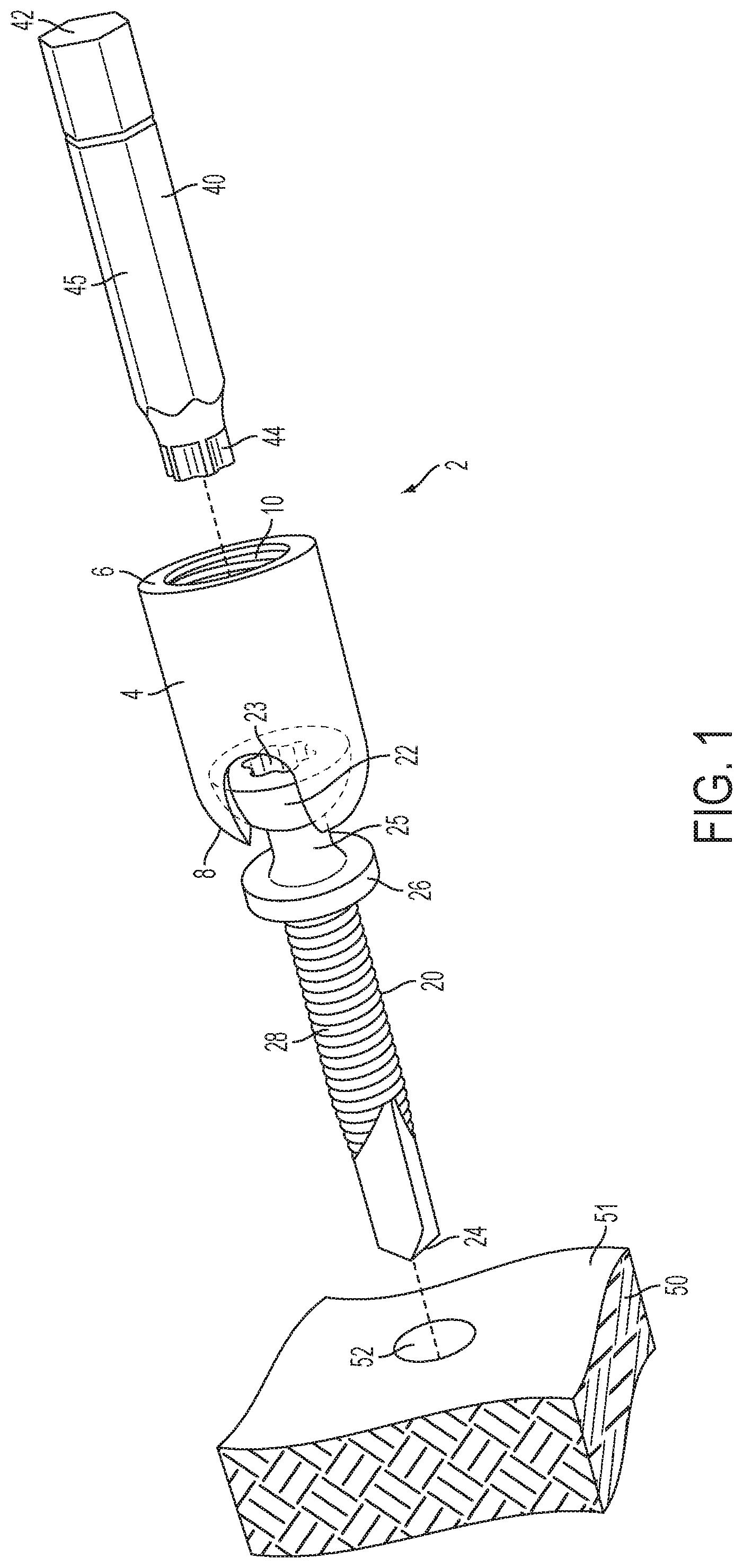 Patent US12504039 — Swivel hanger — Figure 1