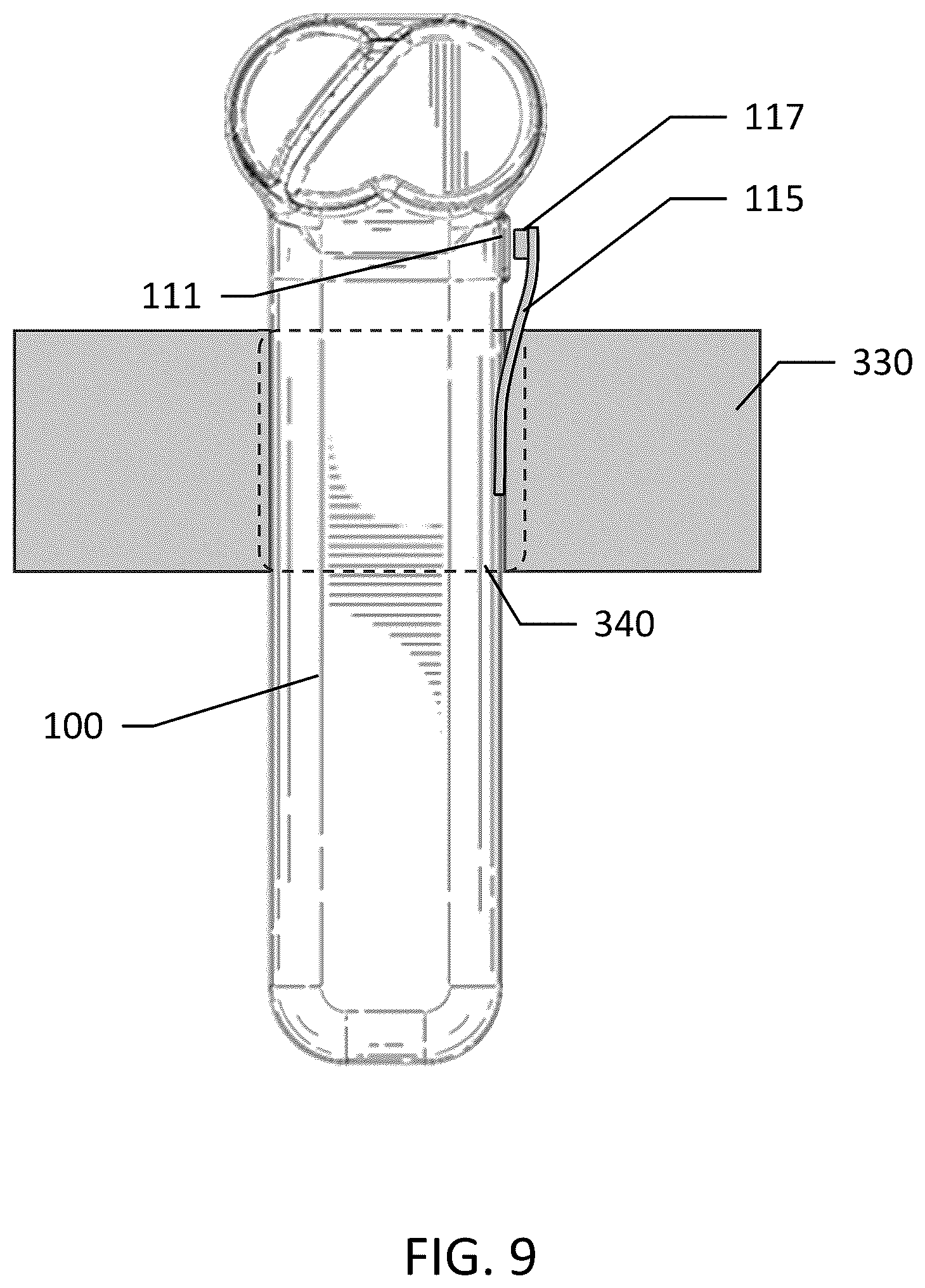 Patent US12504250 Figure 9 – String shooting device