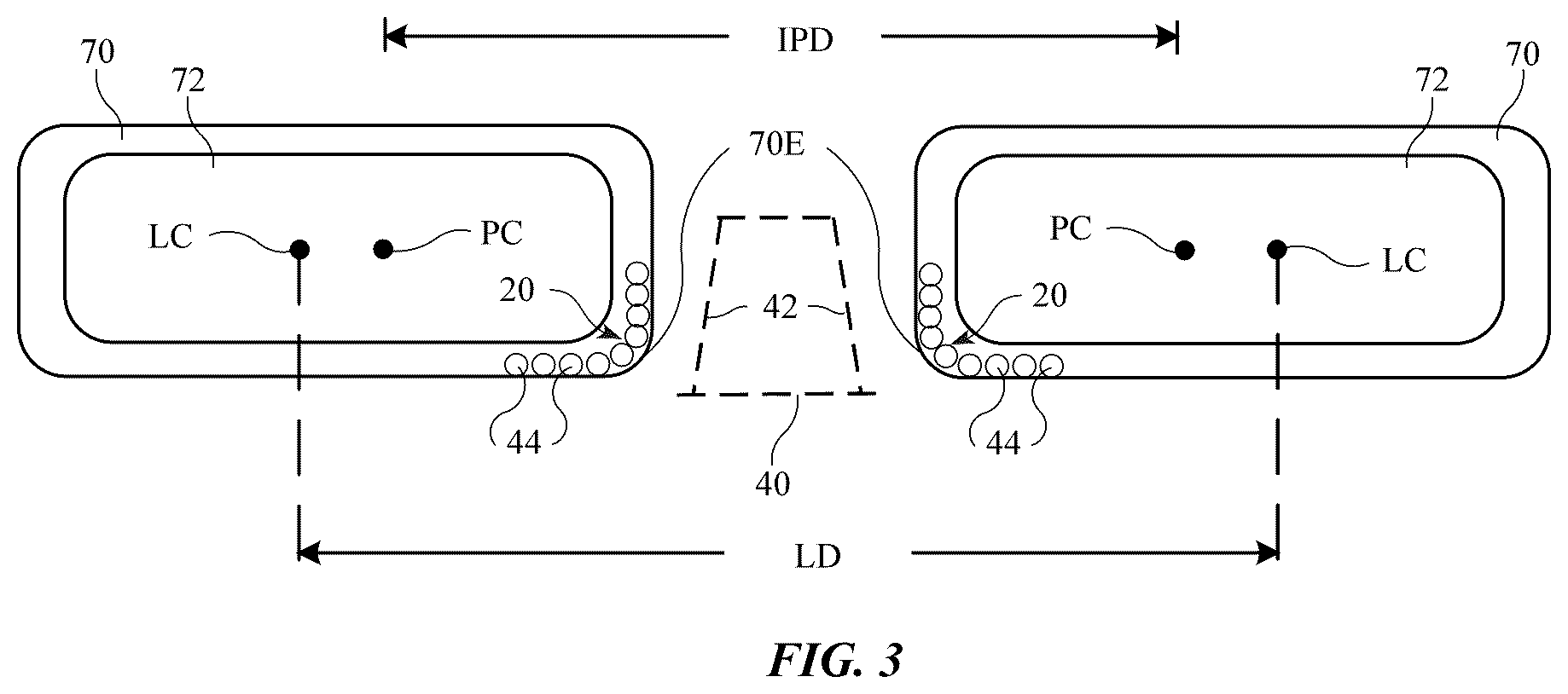 Patent US12504638 Figure 3 – Head-mounted electronic display device with lens position sensing