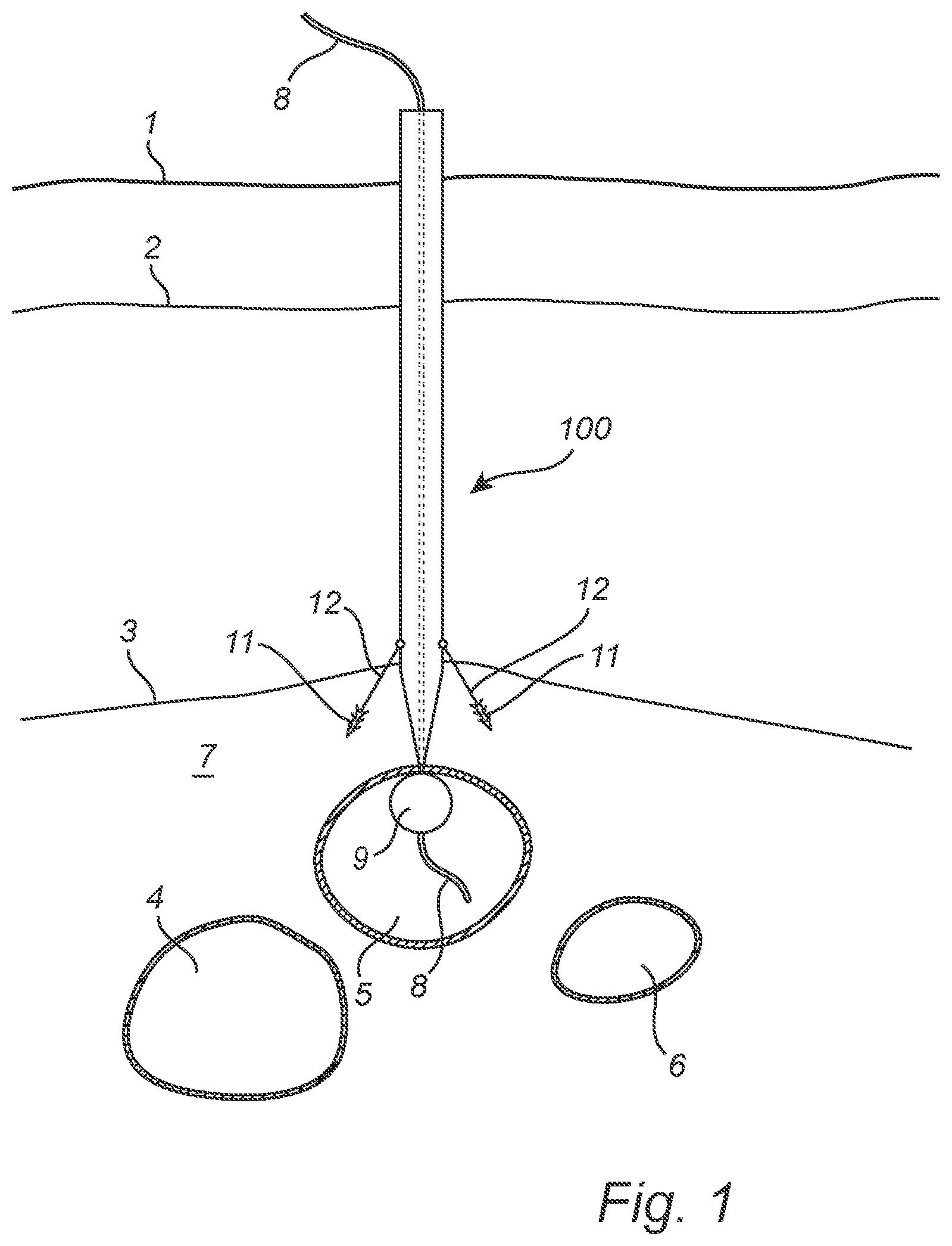 Patent US12508011 Figure 1 – Vascular closure device