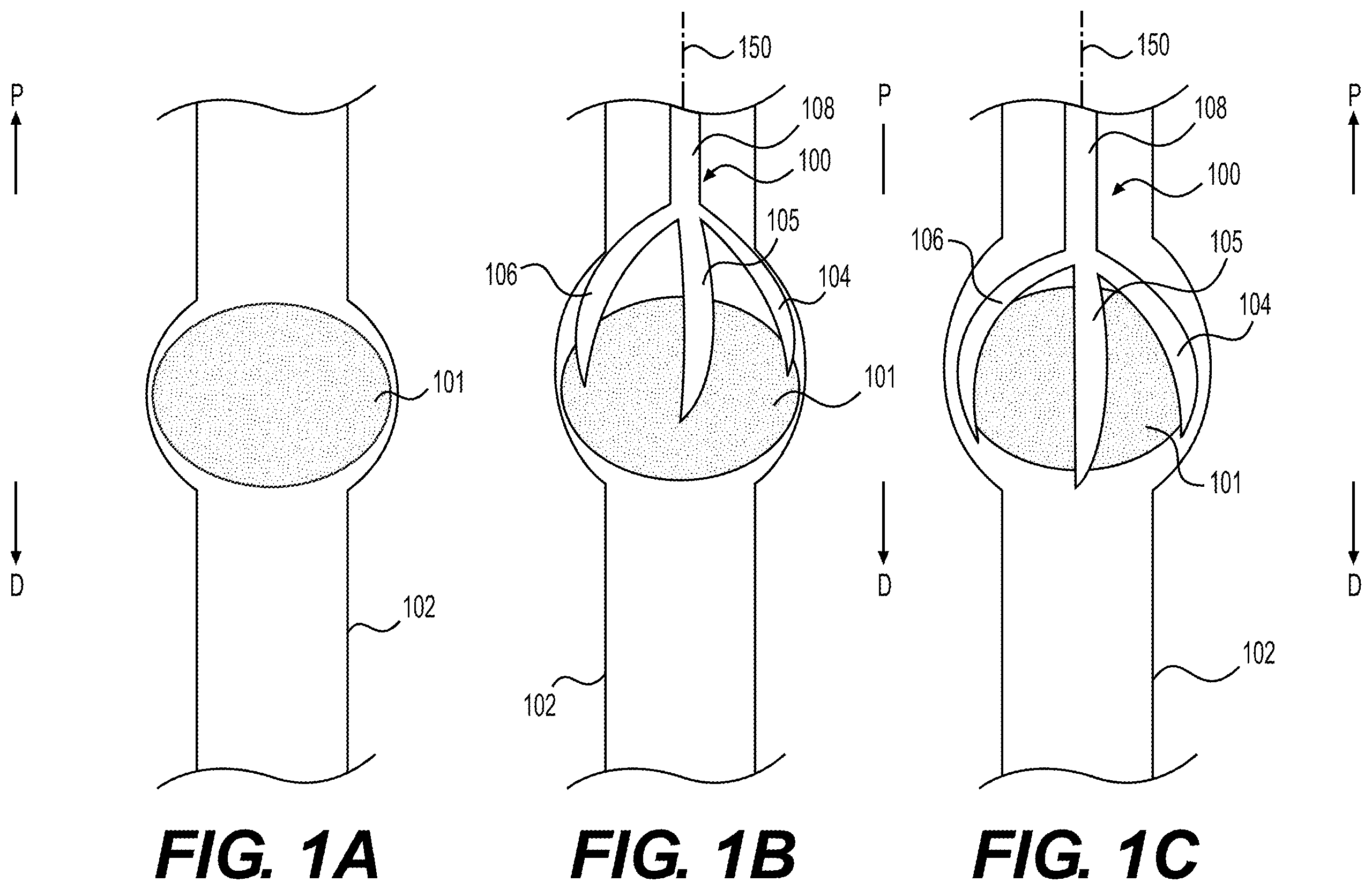 Patent US12508040 — Medical systems, devices, and related methods — Figure 1