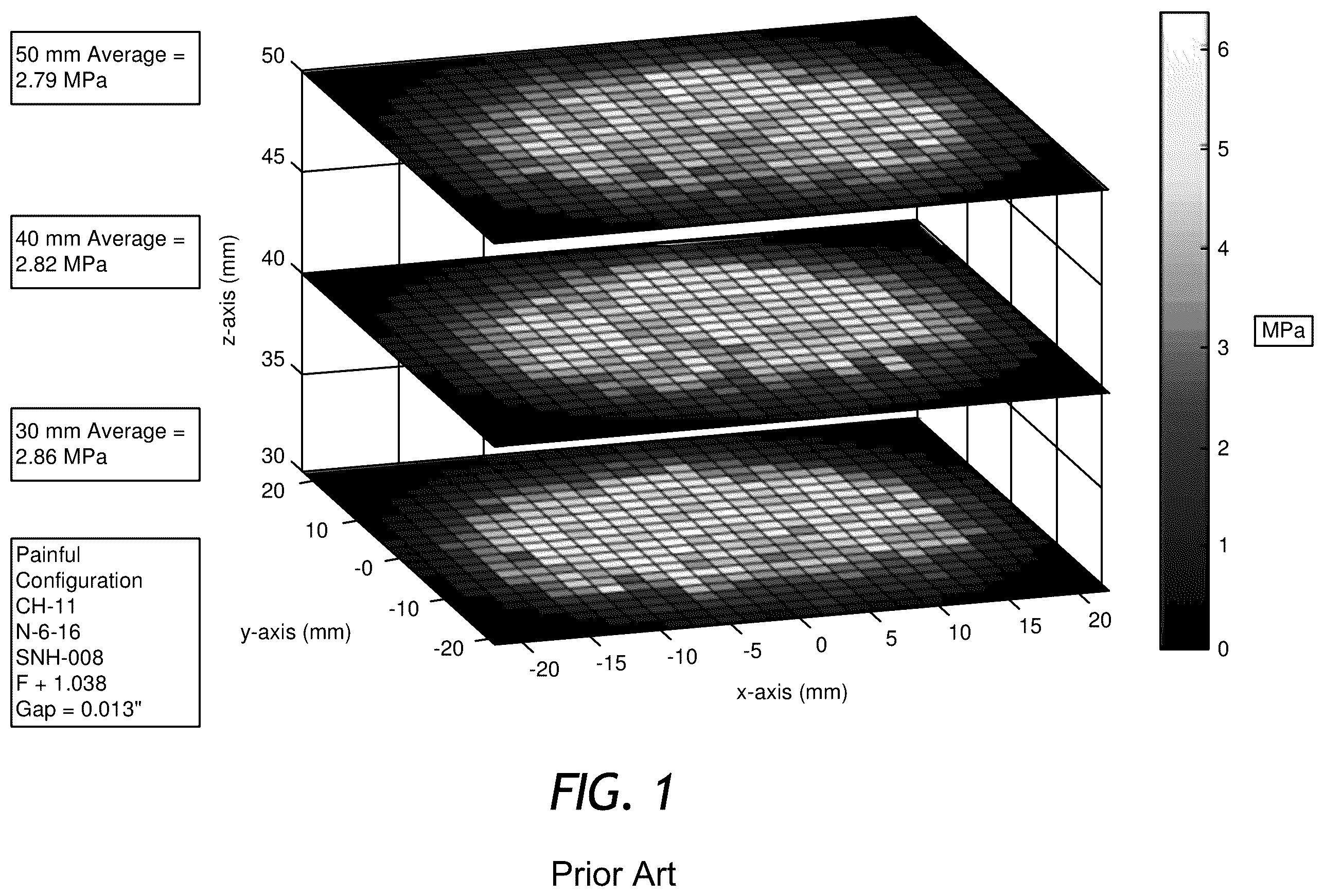 Patent US12508043 Figure 1 – Rapid Pulse electrohydraulic (EH) shockwave generator apparatus with improved acoustic wavefronts
