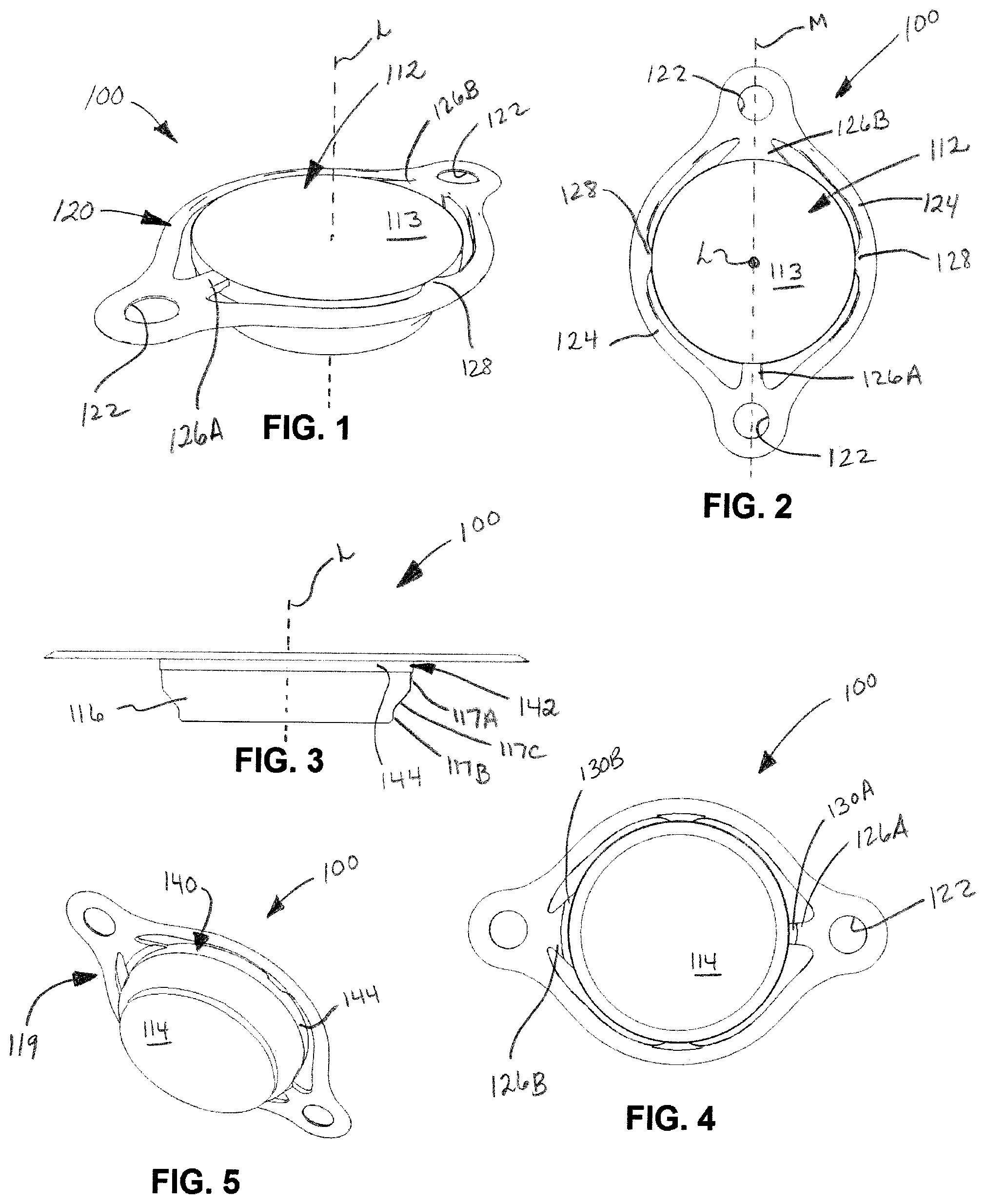 Patent US12508054 Figure 1 – Implants for filling bore holes in bone and methods for filling bore holes in bone