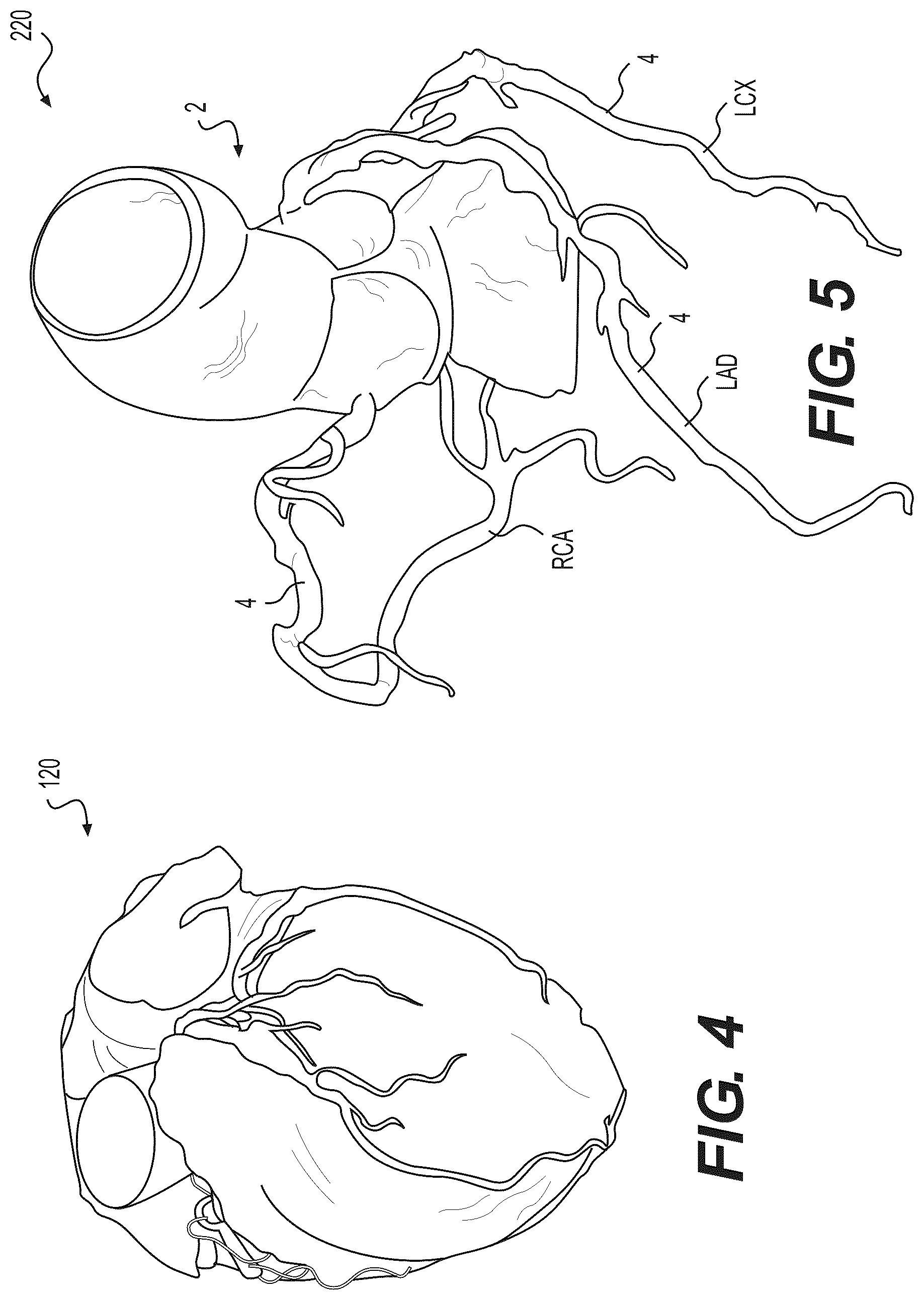 Patent US12508078 Figure 4 – Systems and method for performing particle-based simulation of fluid flow