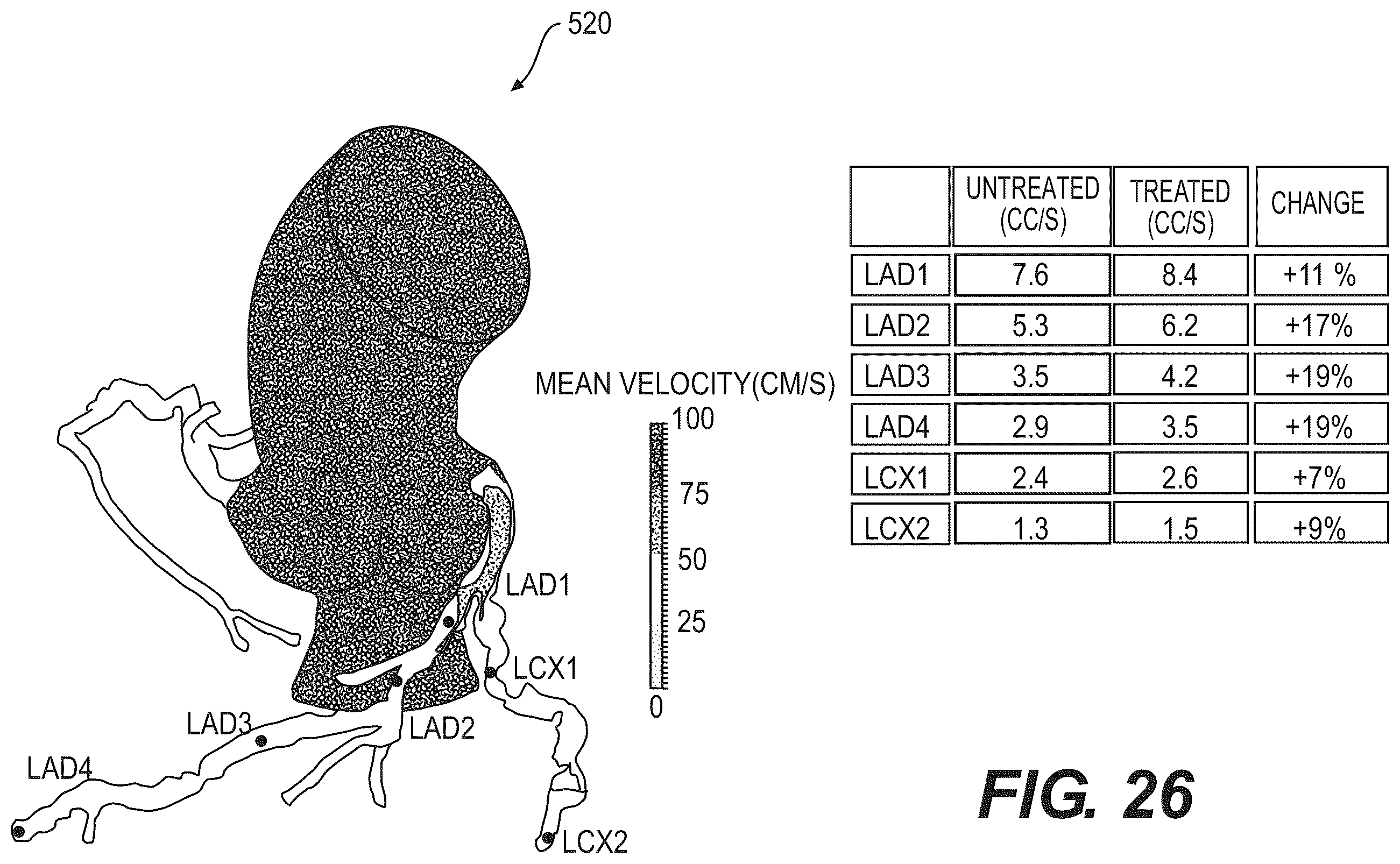 Patent US12508078 Figure 15 – Systems and method for performing particle-based simulation of fluid flow