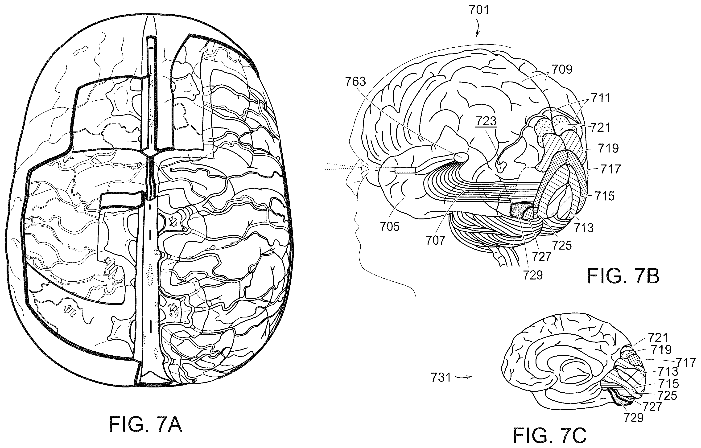 Patent US12508079 Figure 7 – Systems and methods for high-bandwidth minimally invasive brain-computer interfaces