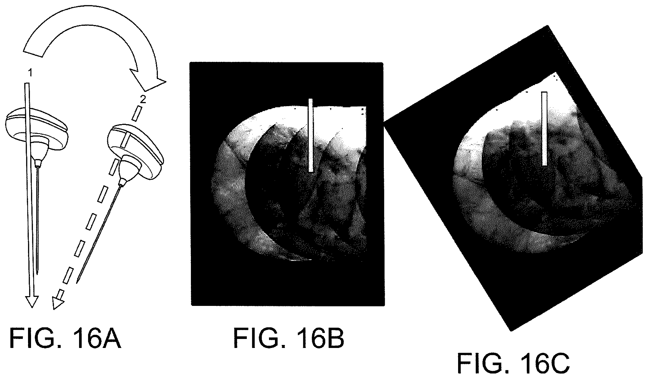 Patent US12508083 Figure 15 – System and method for image localization of effecters during a medical procedure