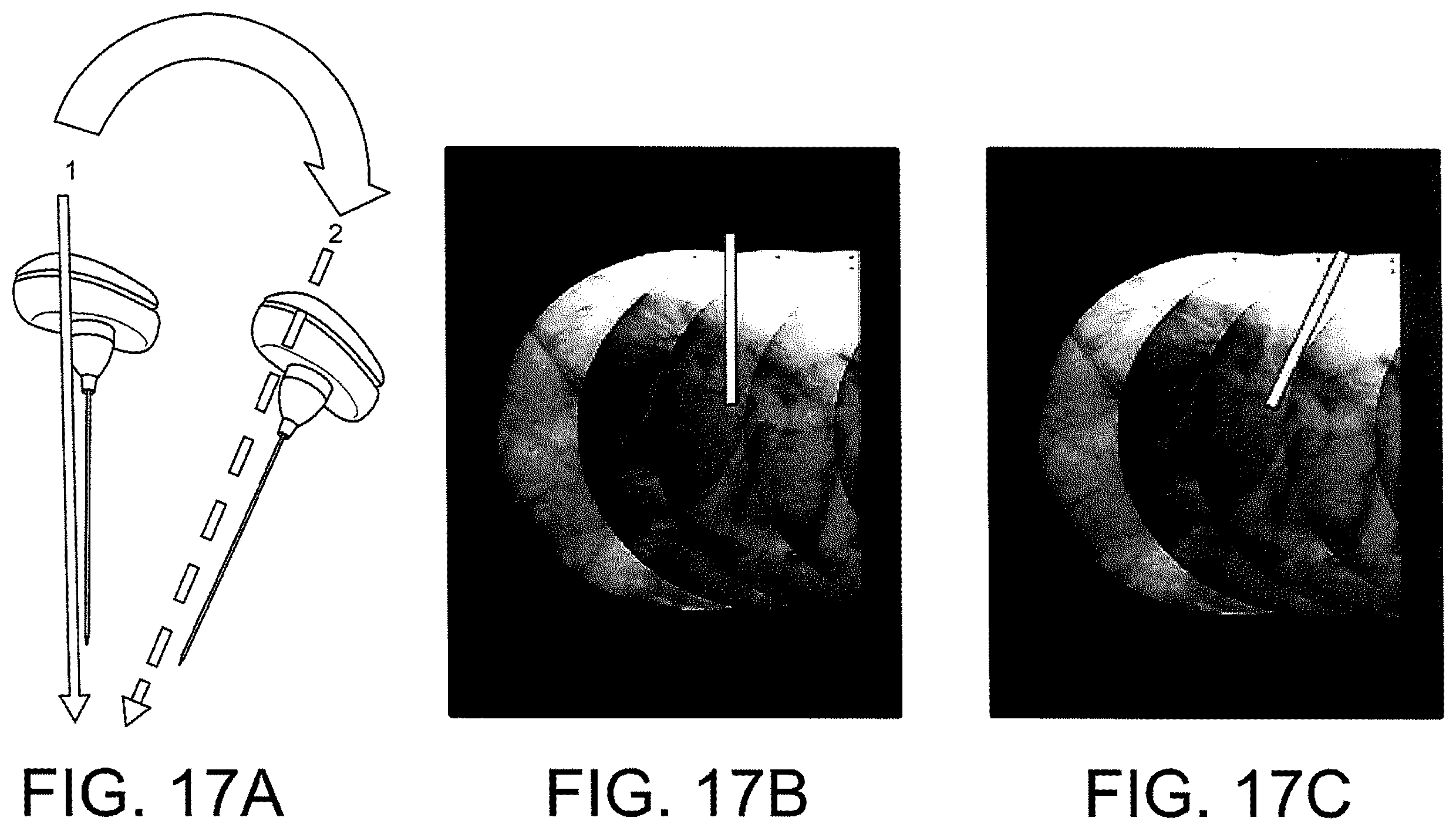 Patent US12508083 Figure 16 – System and method for image localization of effecters during a medical procedure