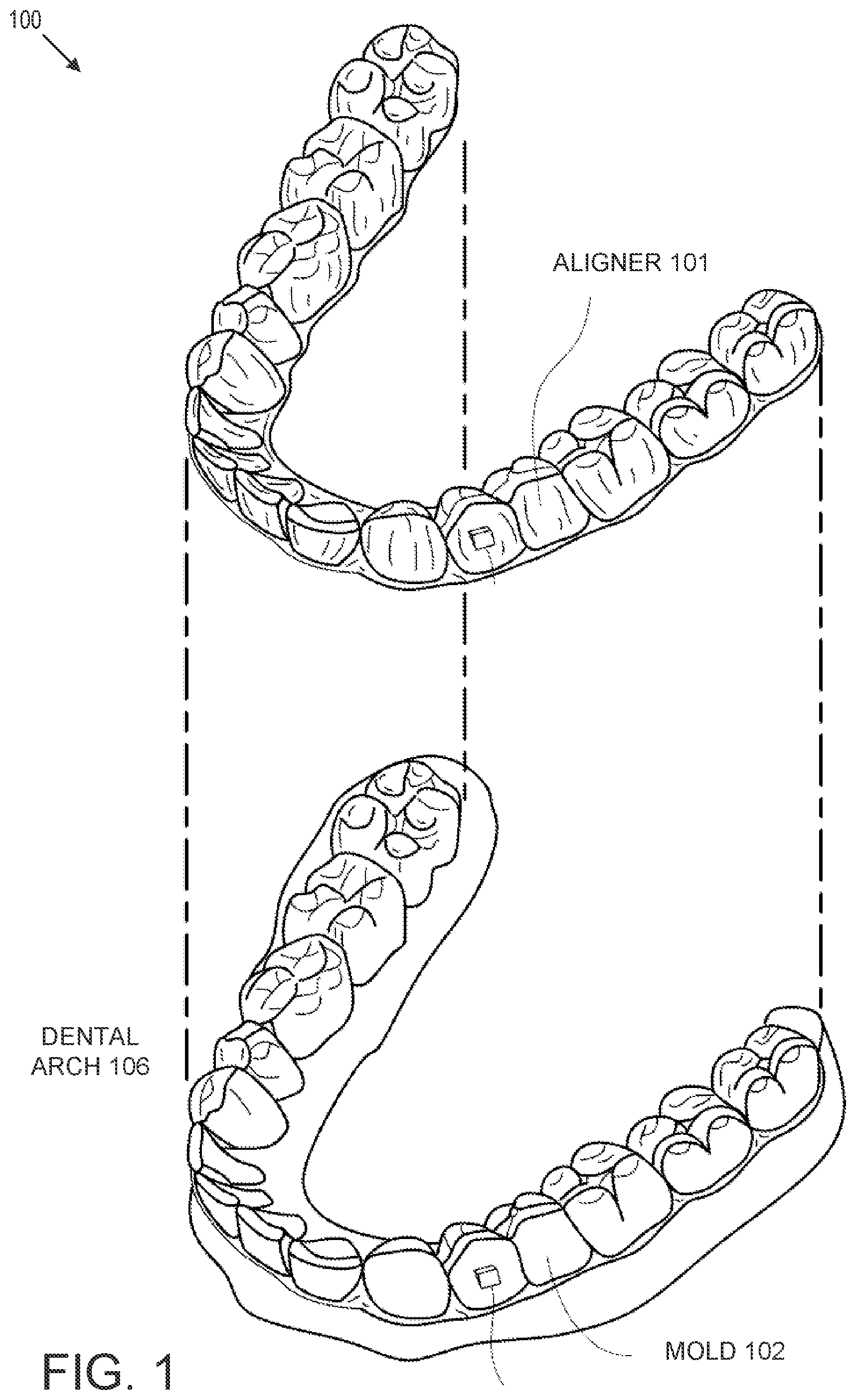 Patent US12508102 Figure 1 – Mold Fabrication using virtual fillers