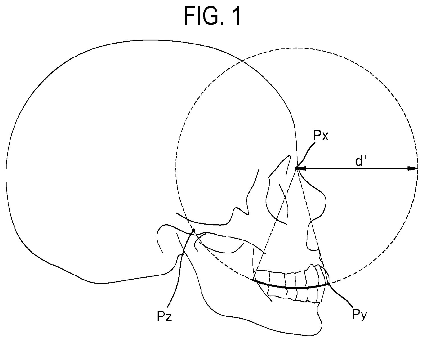 Patent US12508104 Figure 1 – Method for optimizing archline and apparatus using same