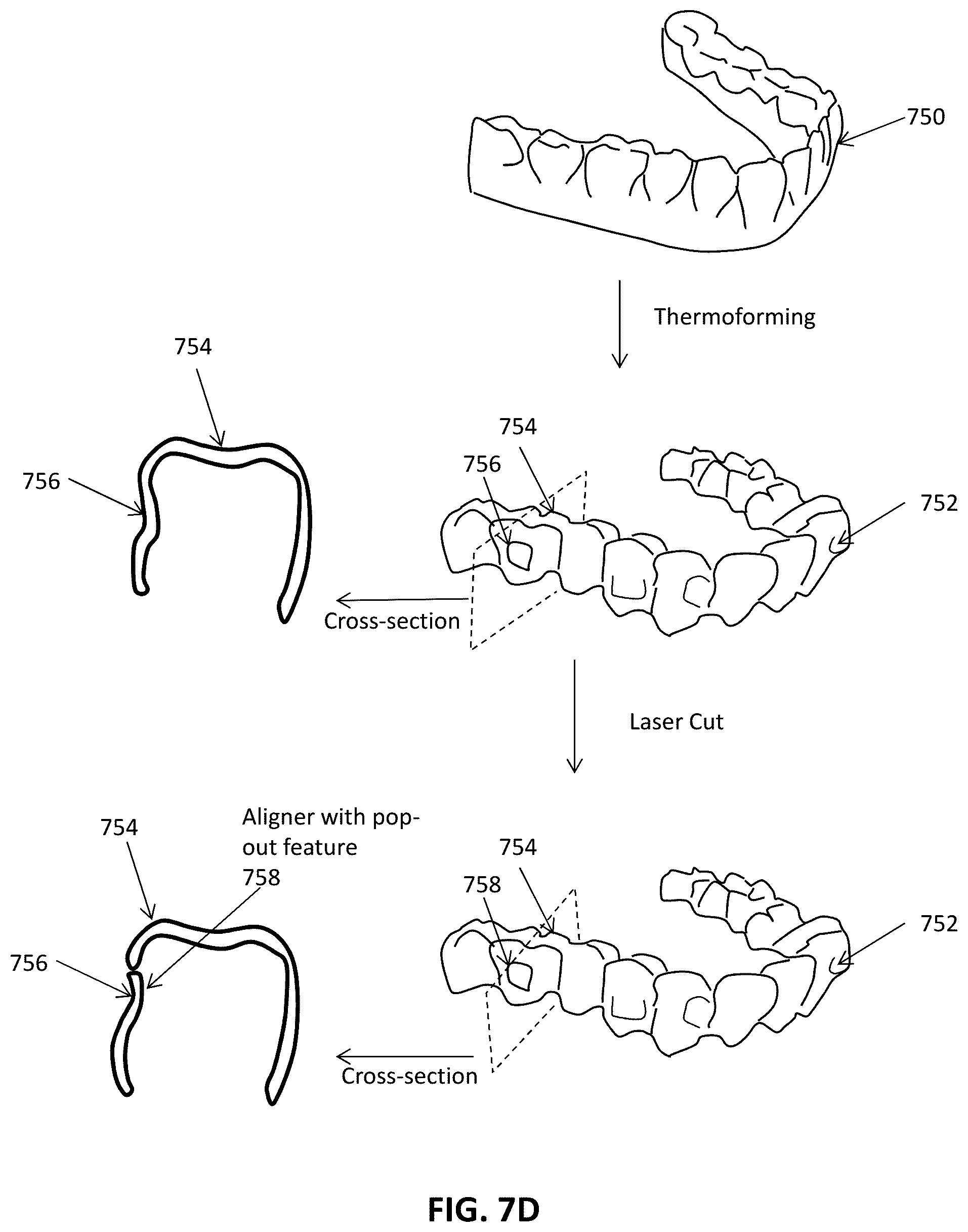 Patent US12508106 Figure 12 – Systems and methods for monitoring orthodontic treatment