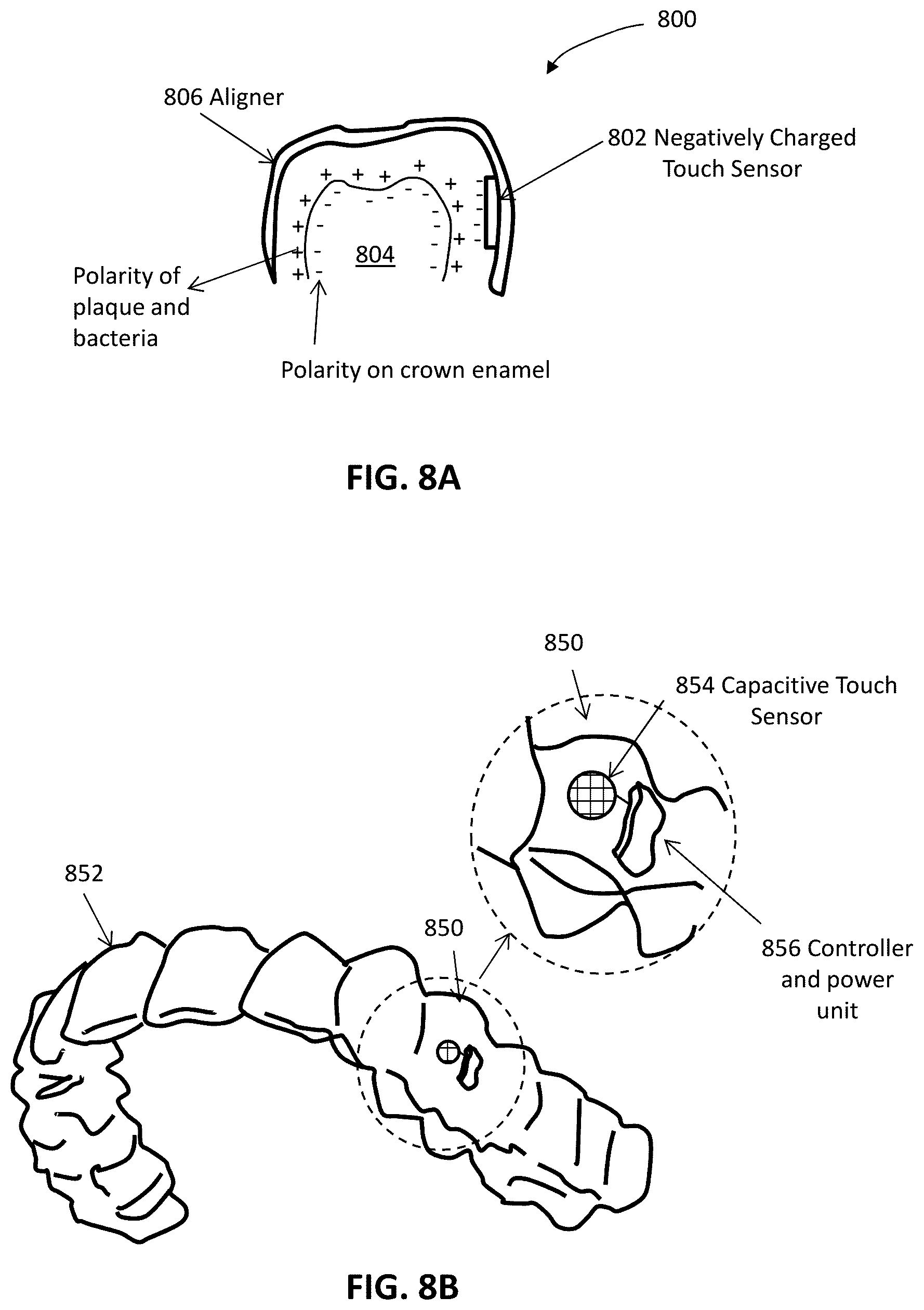 Patent US12508106 Figure 13 – Systems and methods for monitoring orthodontic treatment