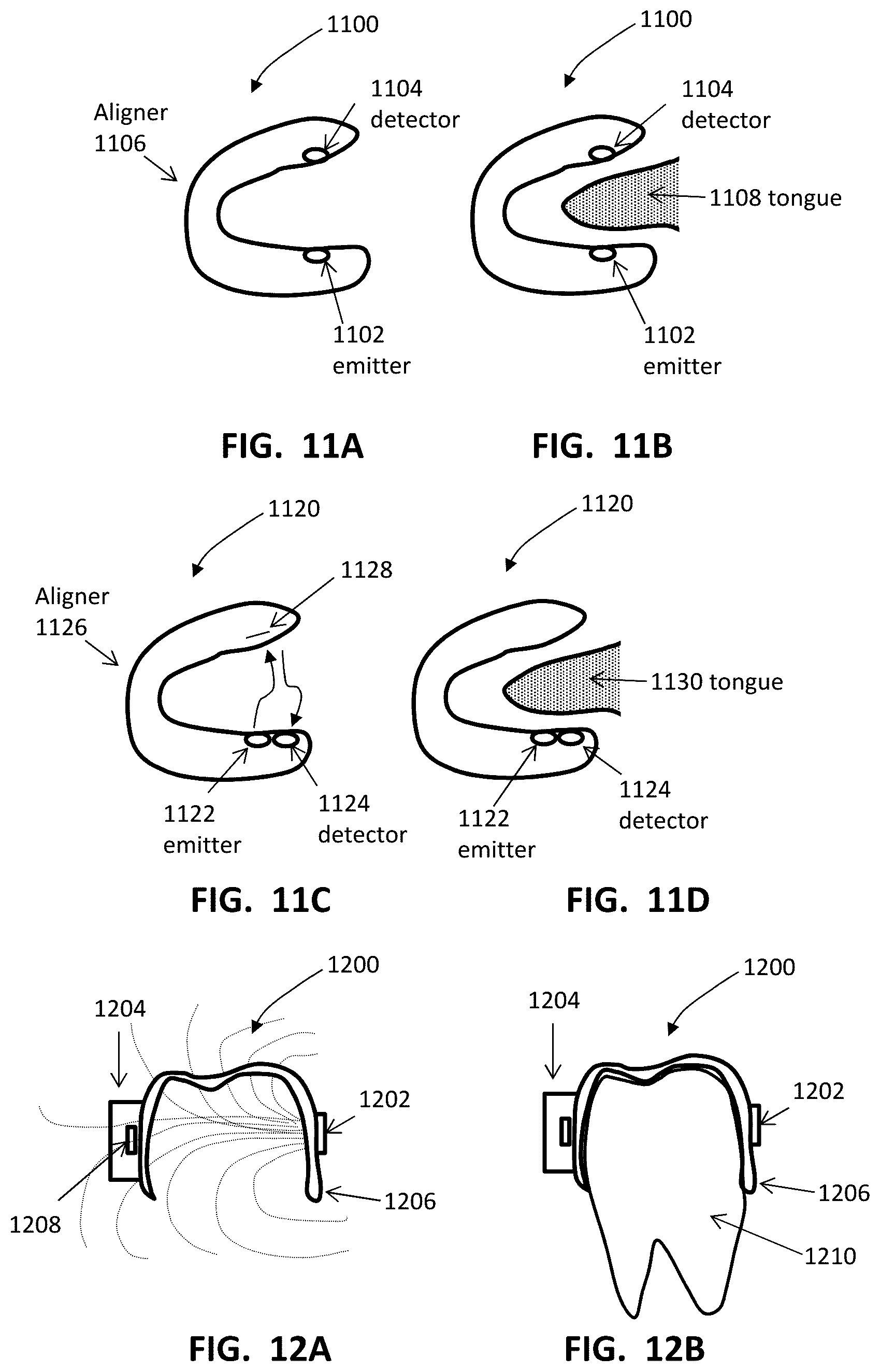 Patent US12508106 Figure 16 – Systems and methods for monitoring orthodontic treatment