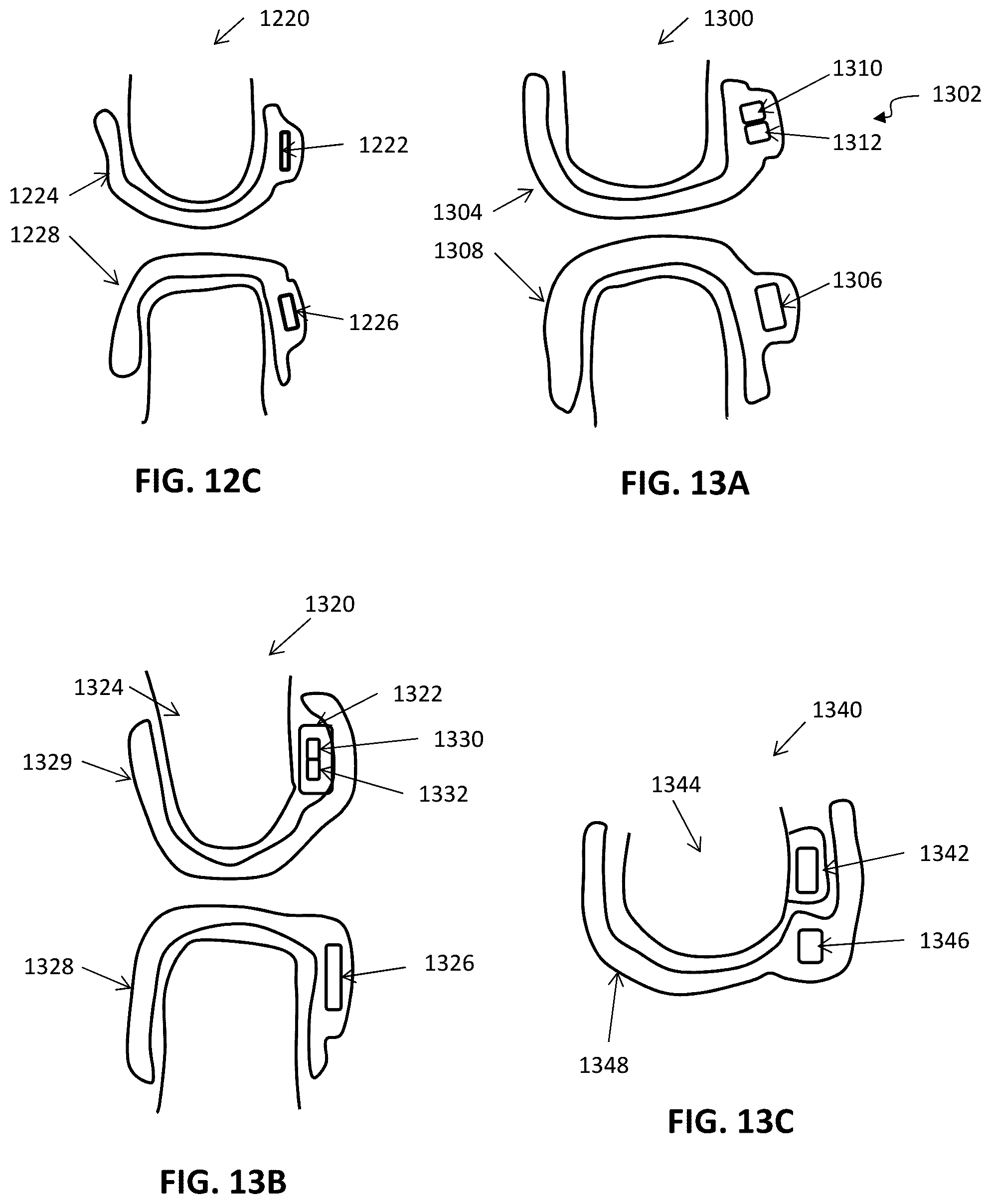 Patent US12508106 Figure 17 – Systems and methods for monitoring orthodontic treatment