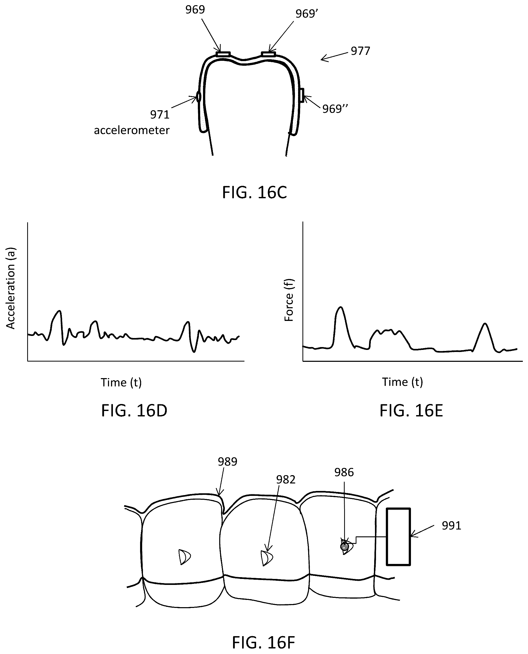 Patent US12508106 Figure 20 – Systems and methods for monitoring orthodontic treatment