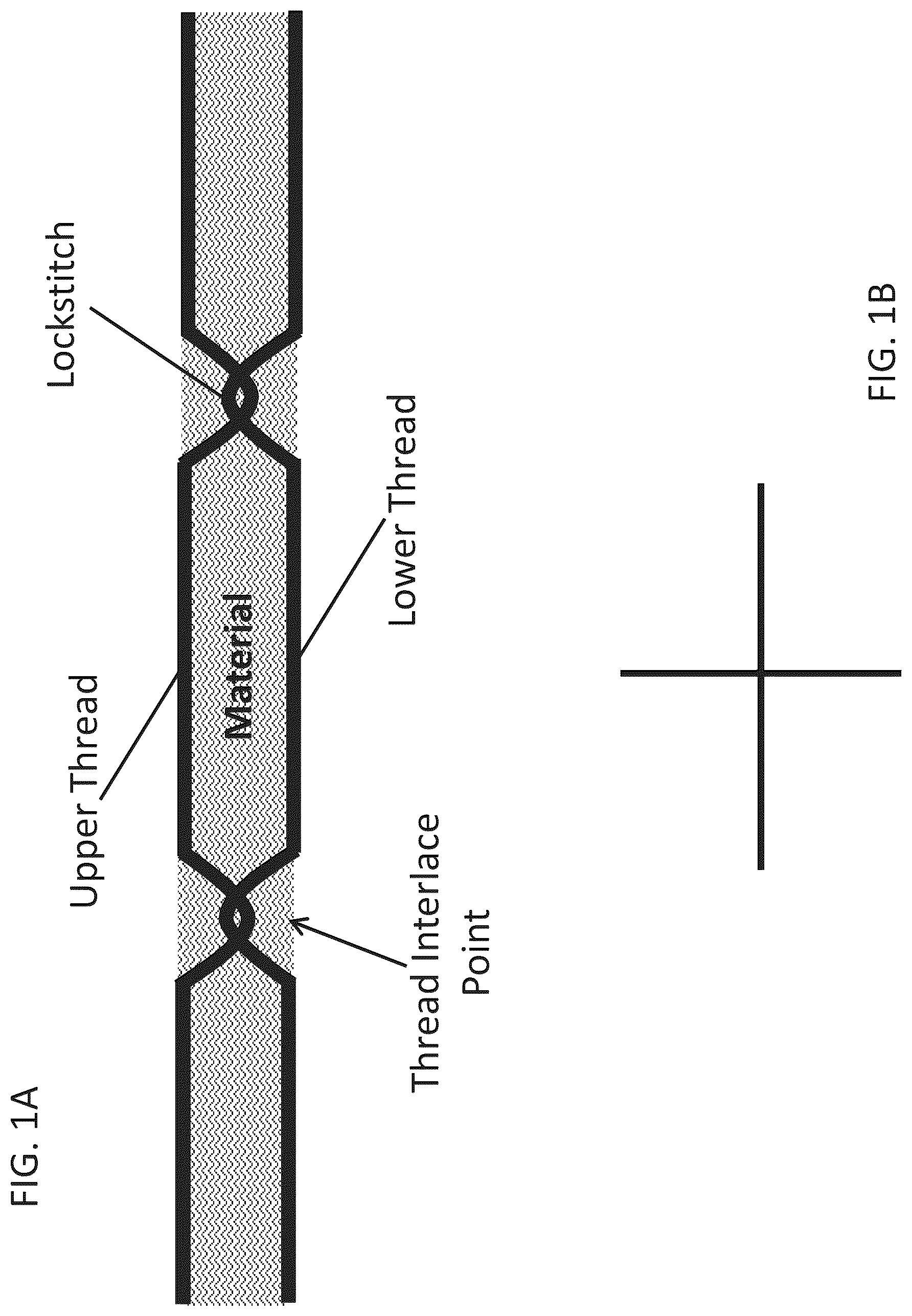 Patent US12508116 — Implants with corner-lock stitch patterns — Figure 1