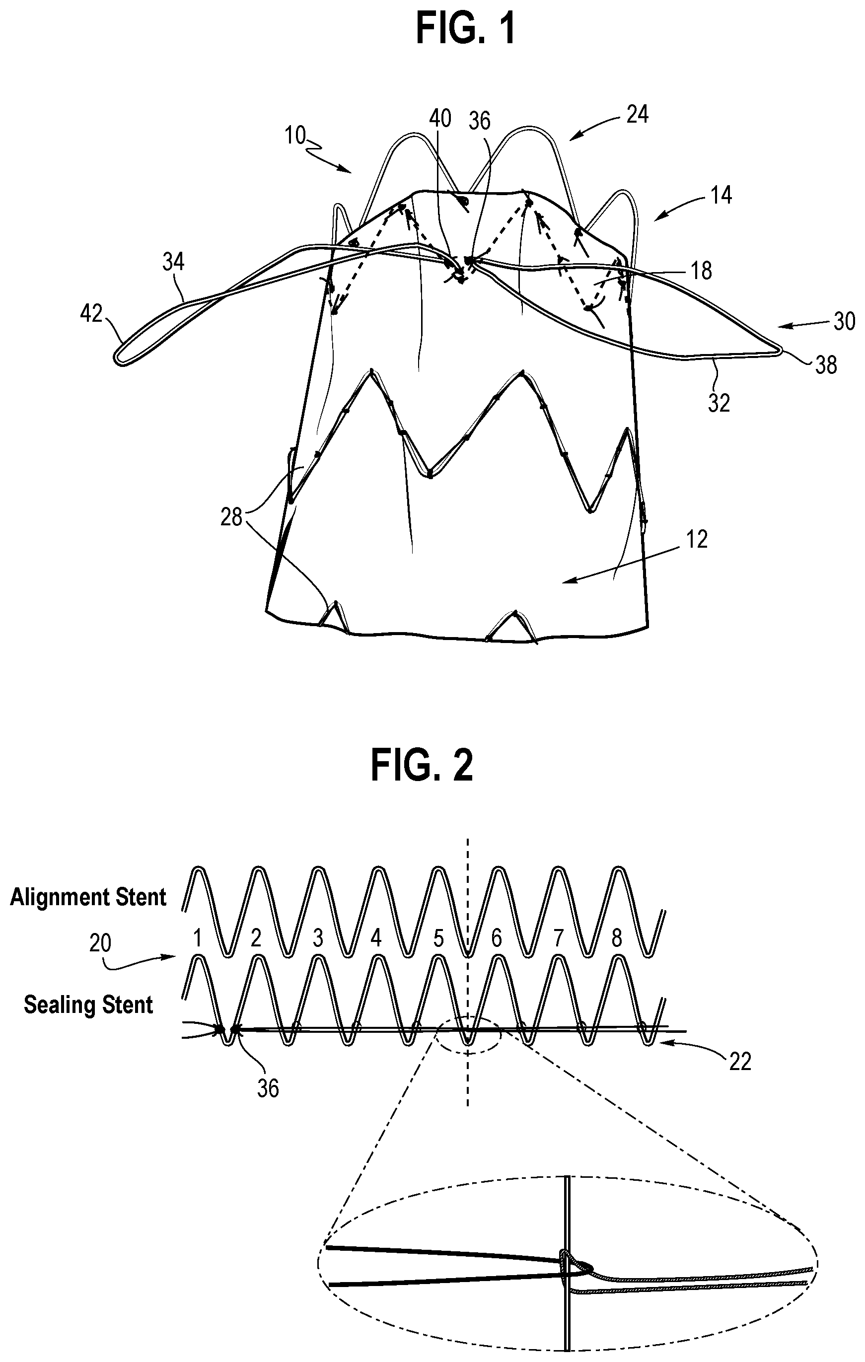 Patent US12508119 — Stent graft — Figure 1