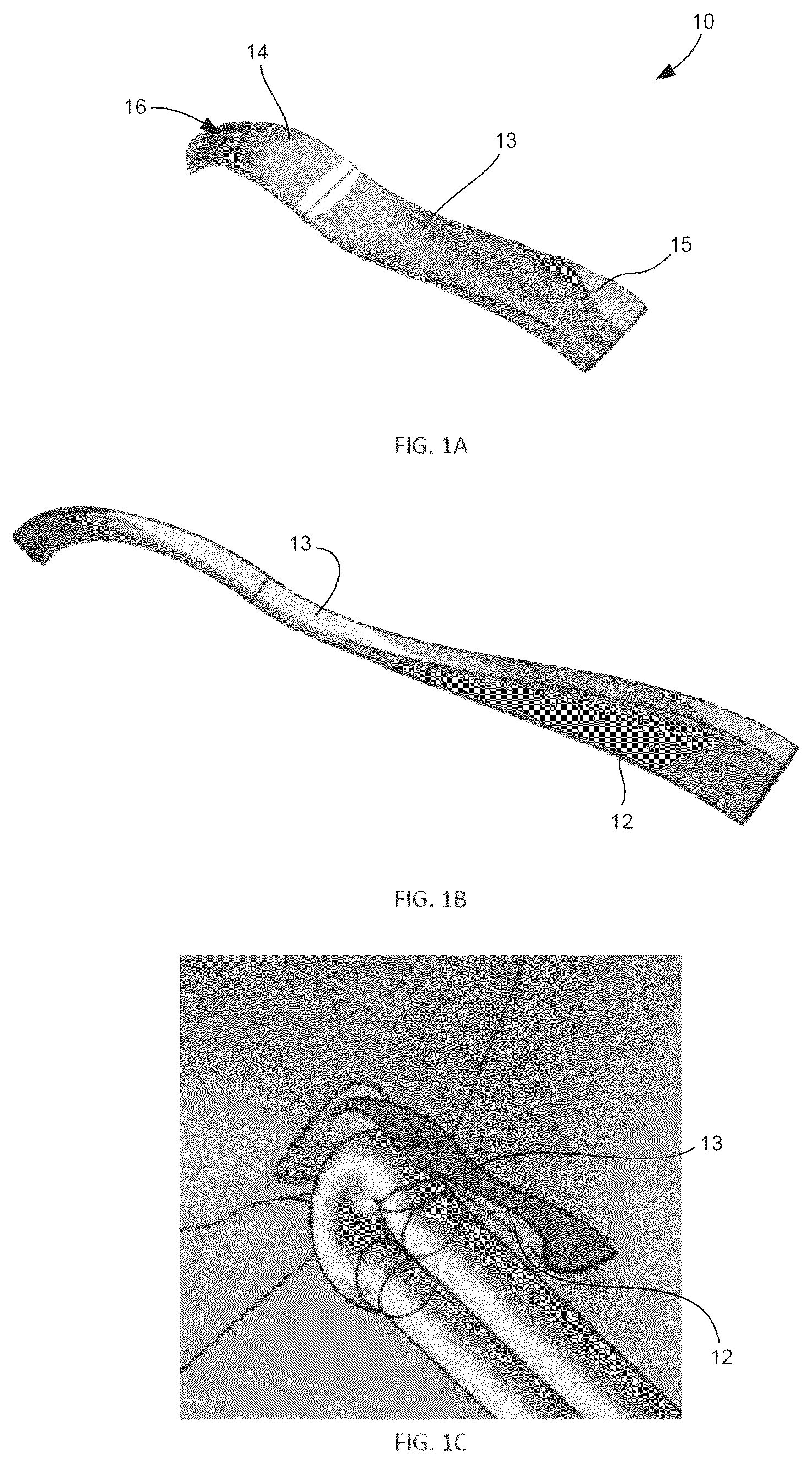 Patent US12508120 — Instrumentation for soft tissue reconstruction — Figure 1