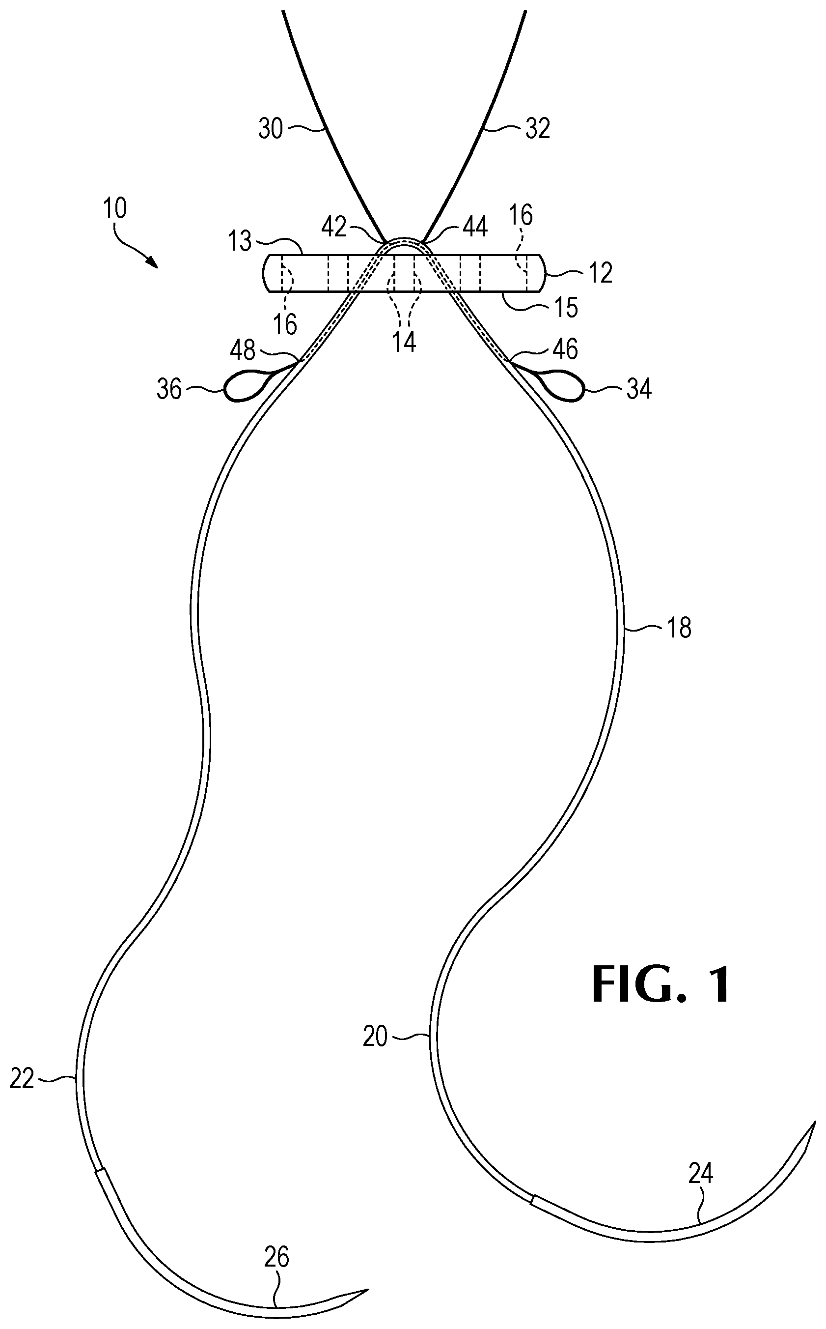 Patent US12508122 Figure 1 – Method of forming a suture-button-graft combination and facilitating construct