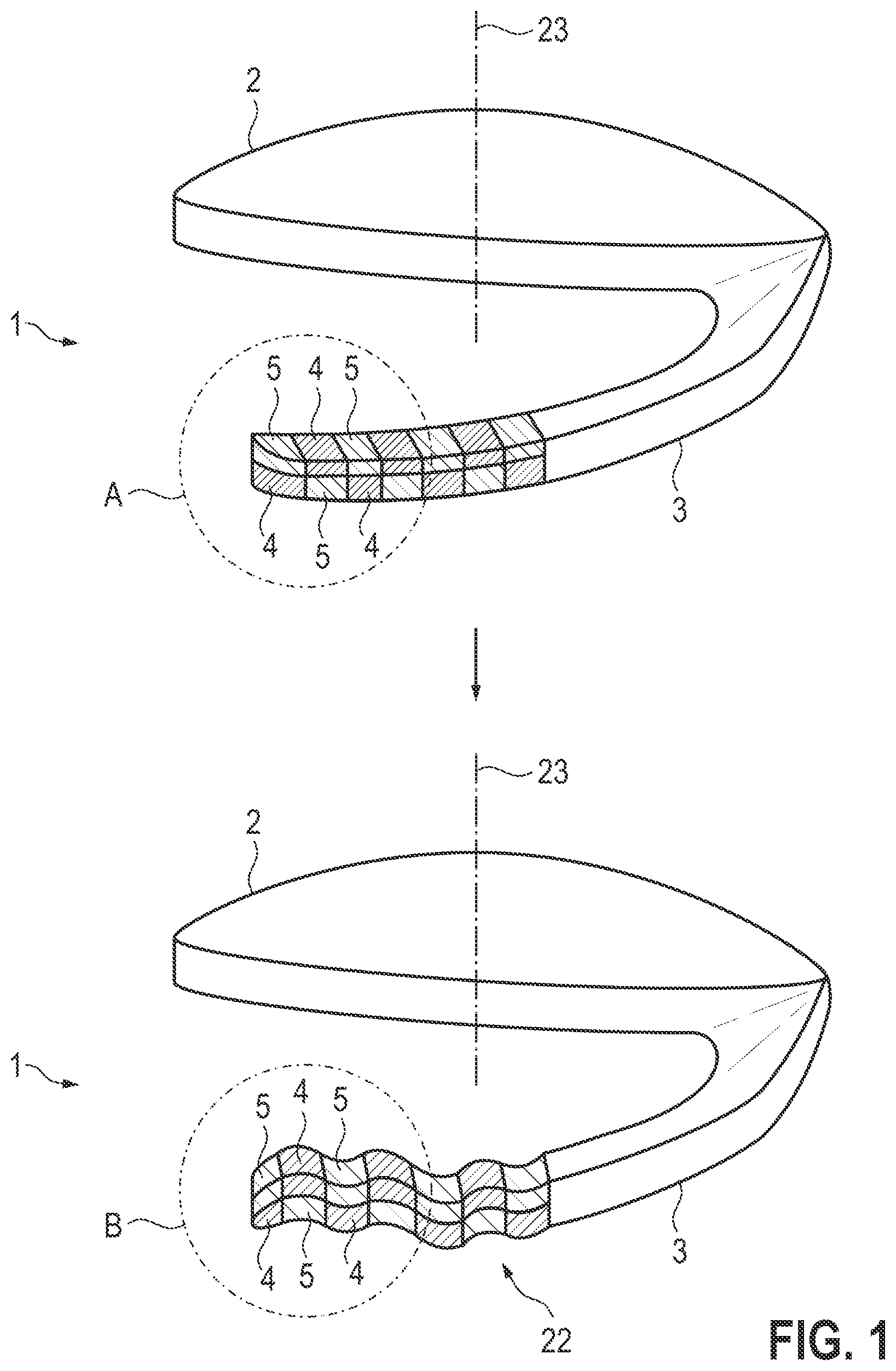 Patent US12508123 Figure 1 – Intraocular lens and treatment apparatus