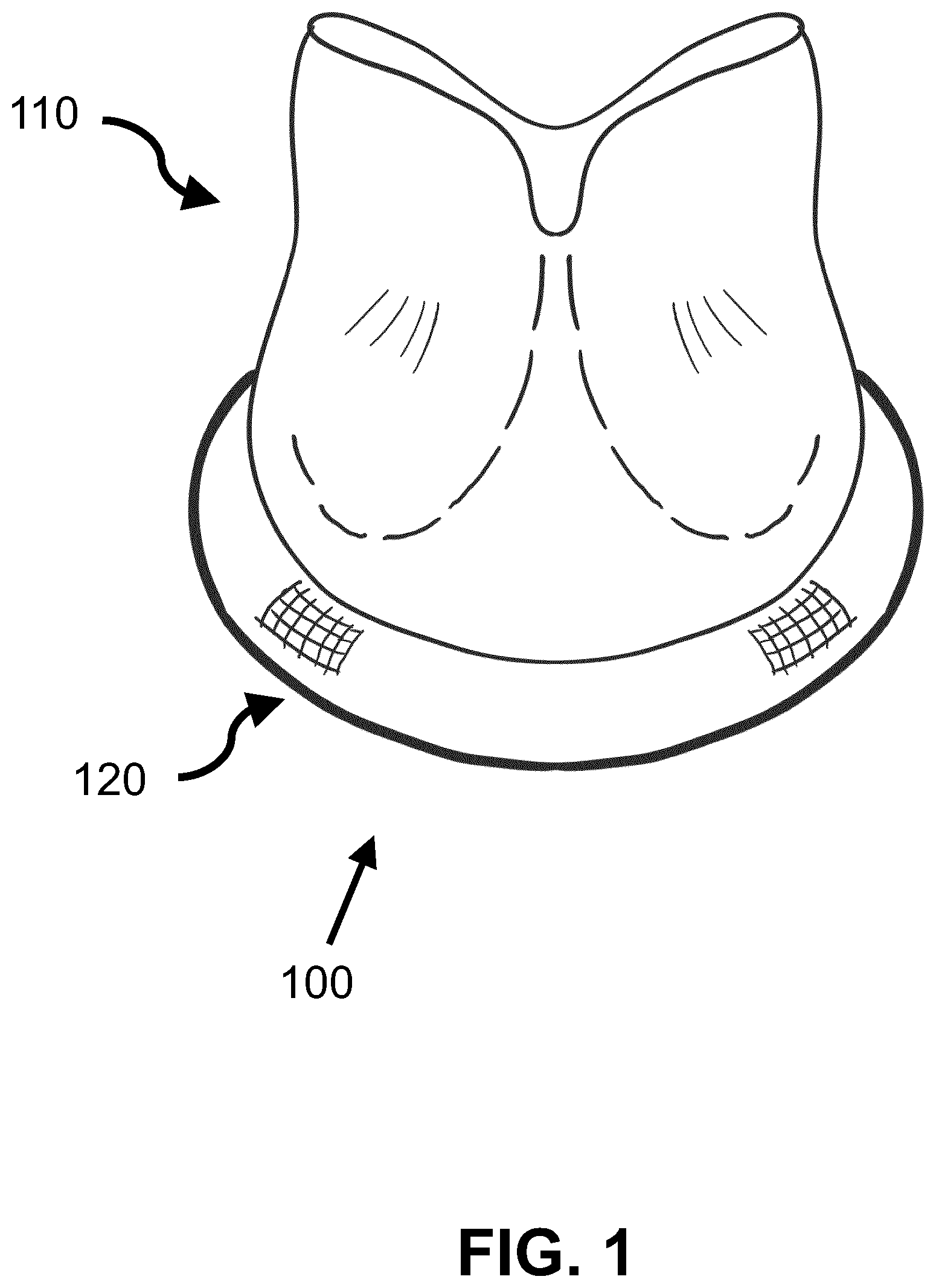 Patent US12508125 — Electrospun suture ring — Figure 1