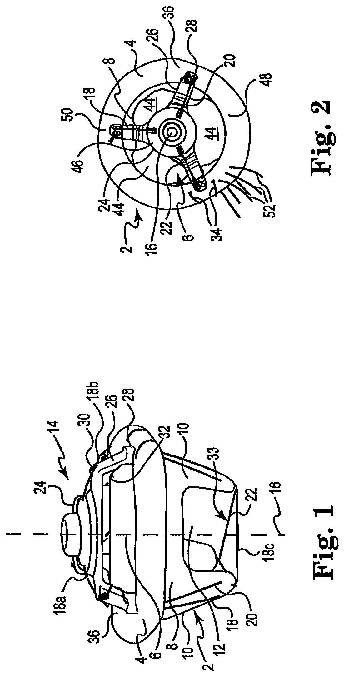 Patent US12508128 Figure 1 – Valve delivery device