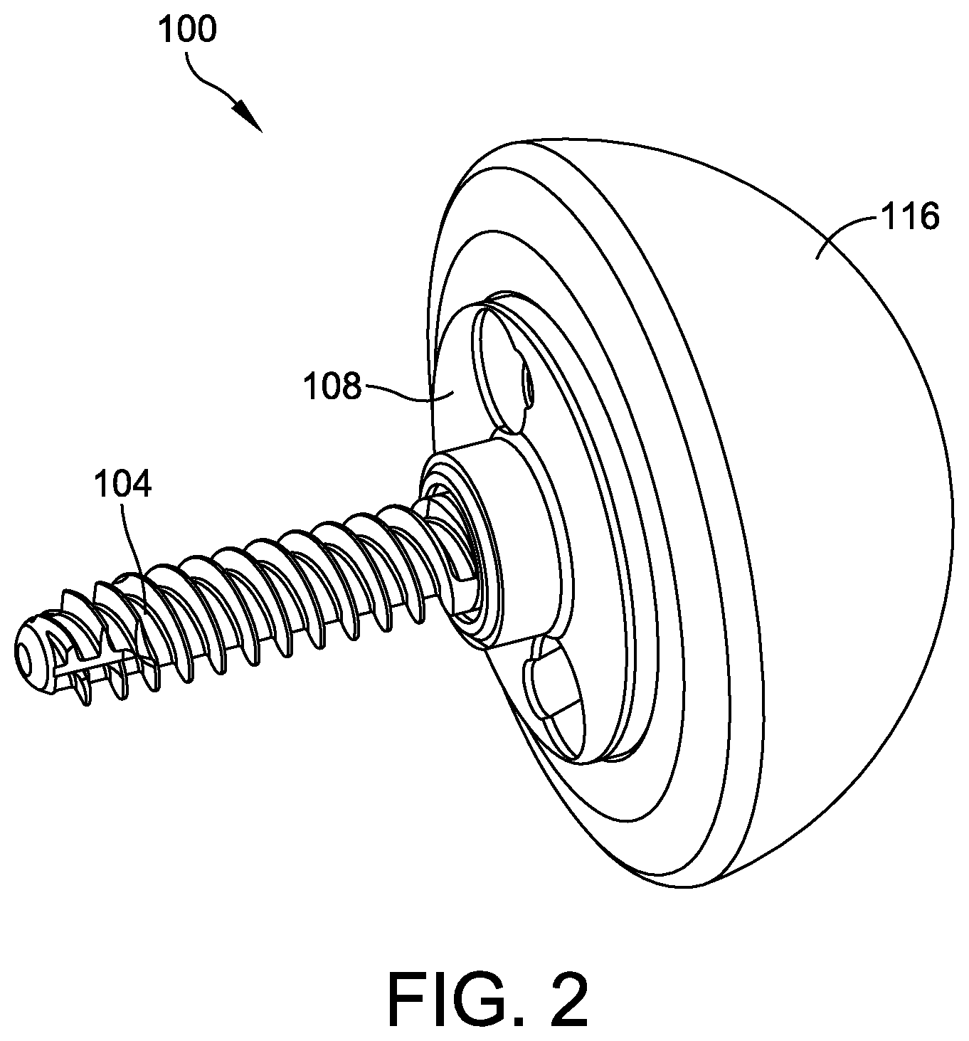 Patent US12508130 Figure 2 – Glenoid implant components and instruments therefor