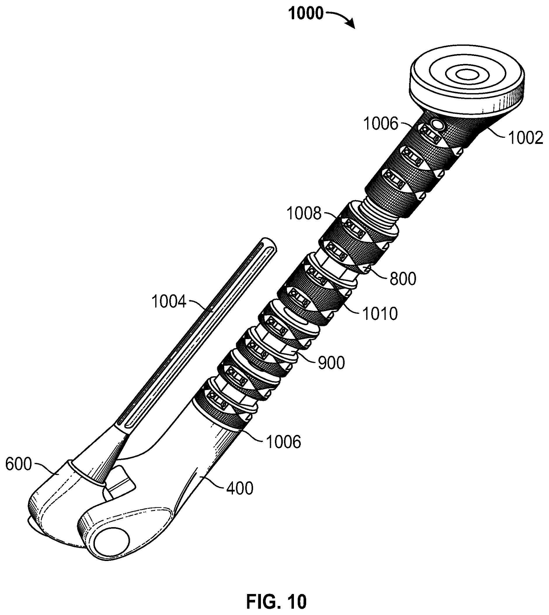 Patent US12508133 Figure 6 – Prosthesis surface treatment for soft tissue attachment thereto