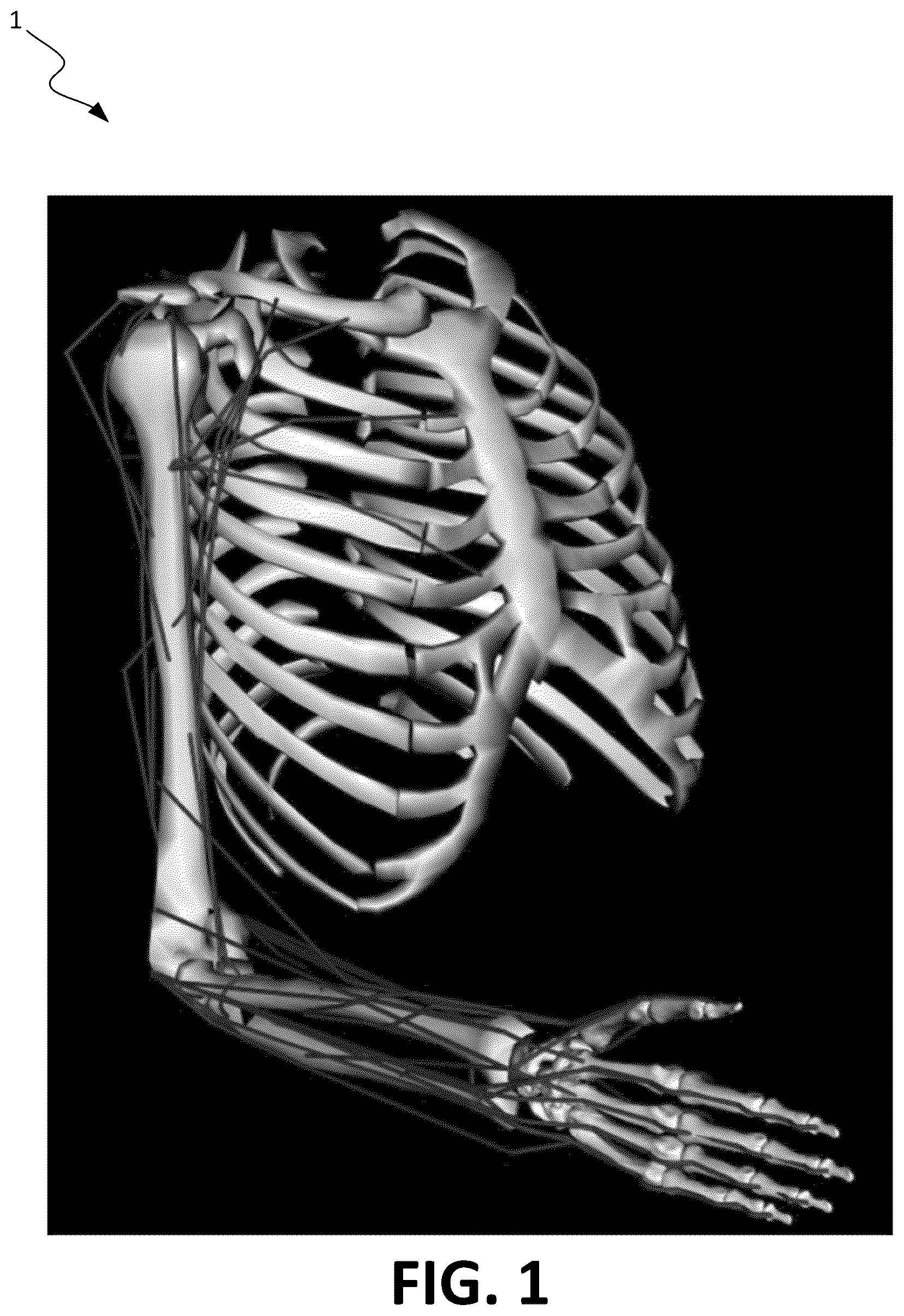 Patent US12508138 — Systems and methods for approximating musculoskeletal dynamics — Figure 1