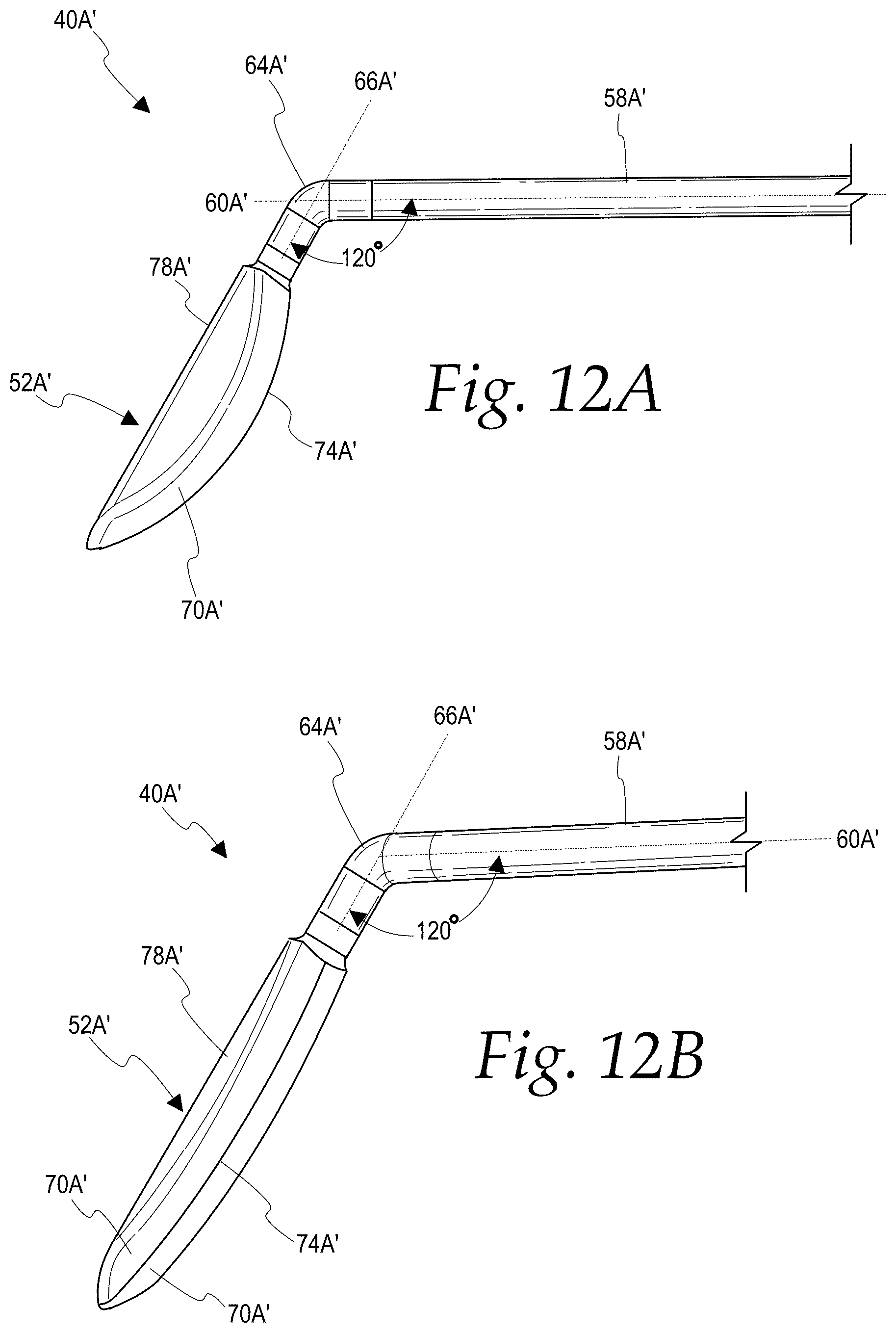 Patent US12508160 Figure 3 – Methods for treating glaucoma
