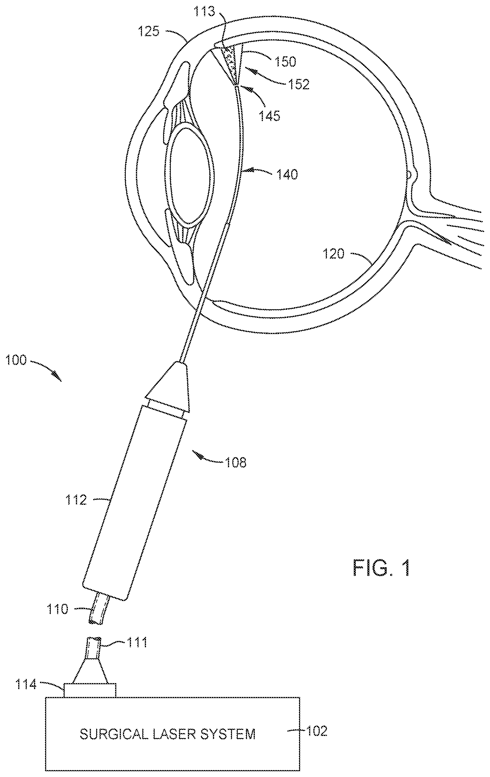 Patent US12508161 — Single-fiber illuminated laser probe with adjustable color — Figure 1