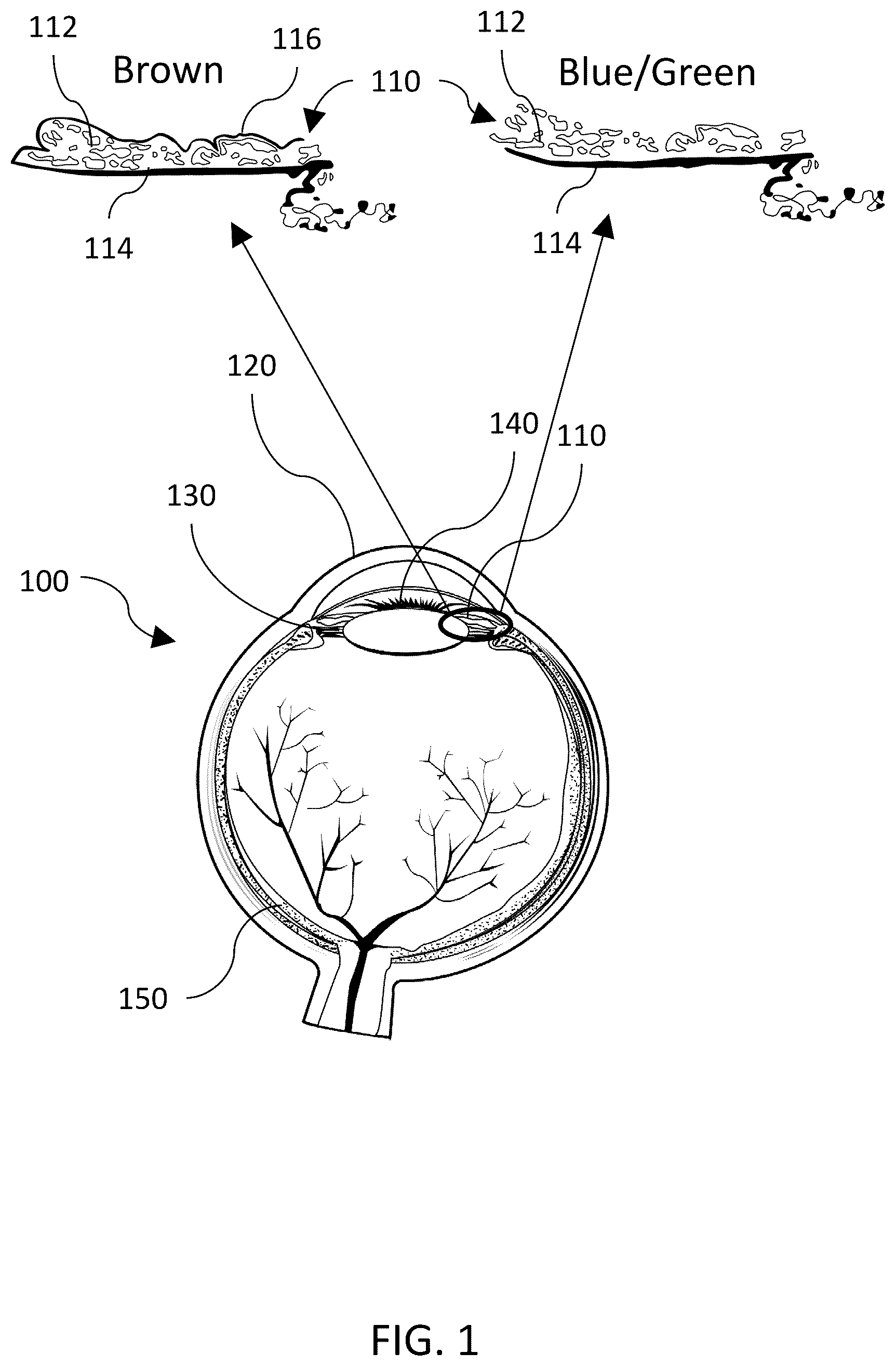 Patent US12508162 — Laser systems and methods for alteration of eye color — Figure 1