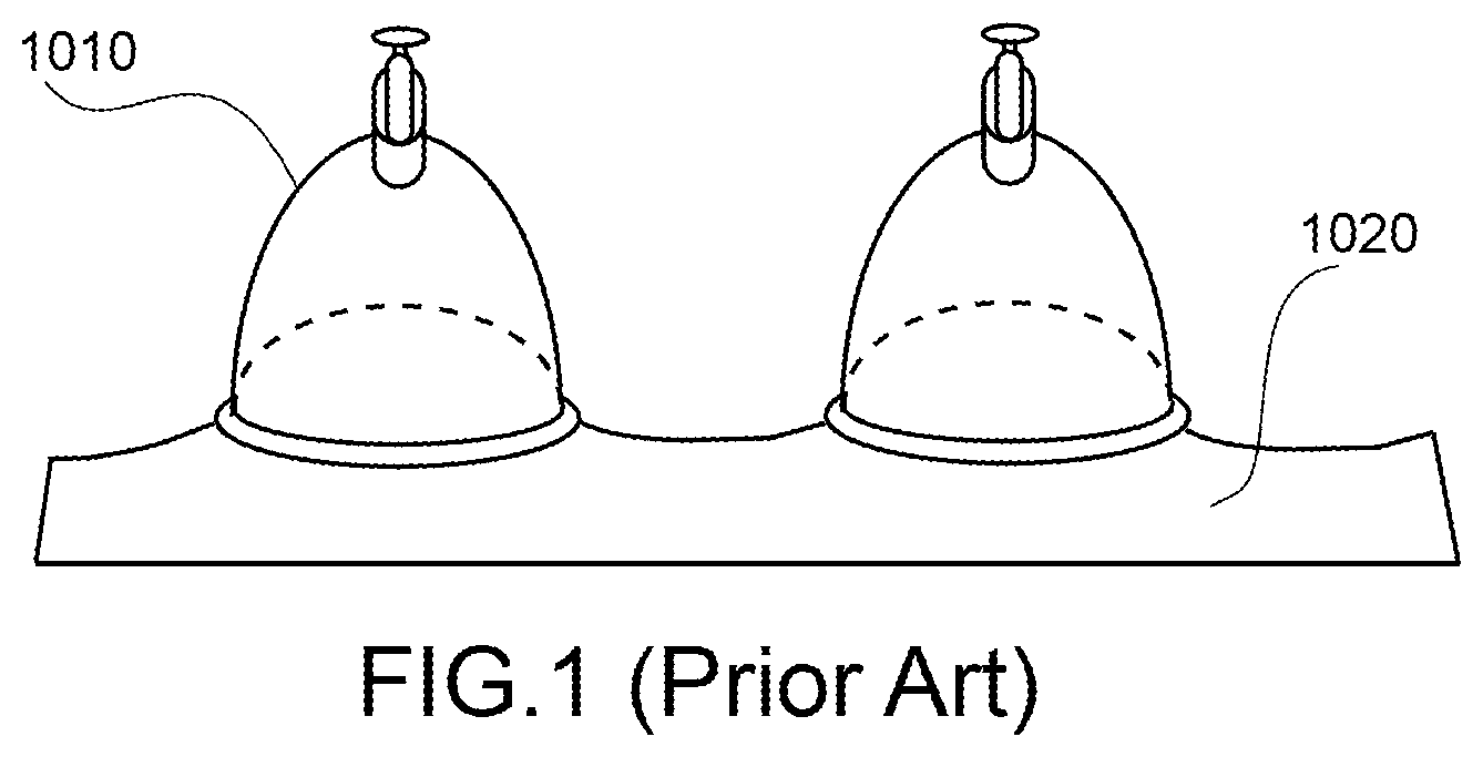 Patent US12508189 — Methods and apparatus for treating pain and mobility impairment — Figure 1