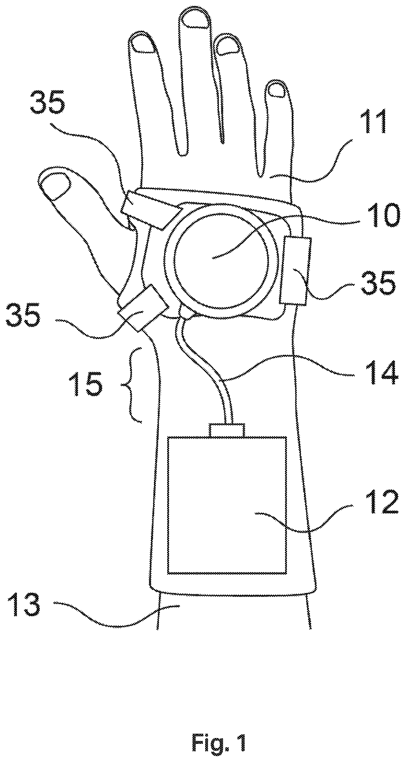 Patent US12508199 — Tremor stabilisation apparatus — Figure 1