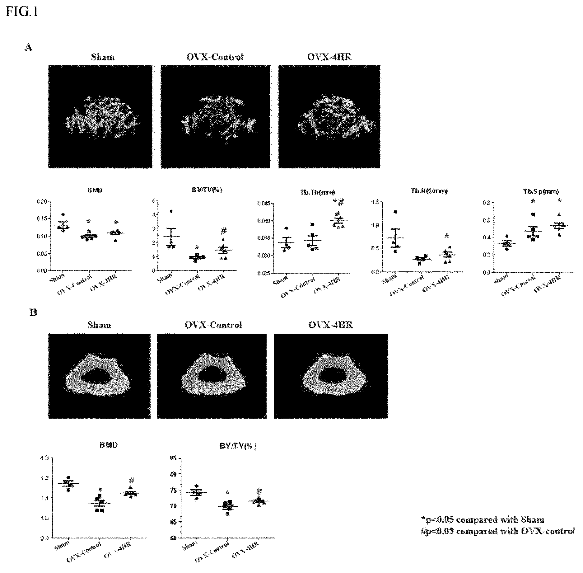 Patent US12508237 — Pharmaceutical composition comprising 4-hexylresorcinol as active ingredient for prevention or treatment of bone disease — Figure 1