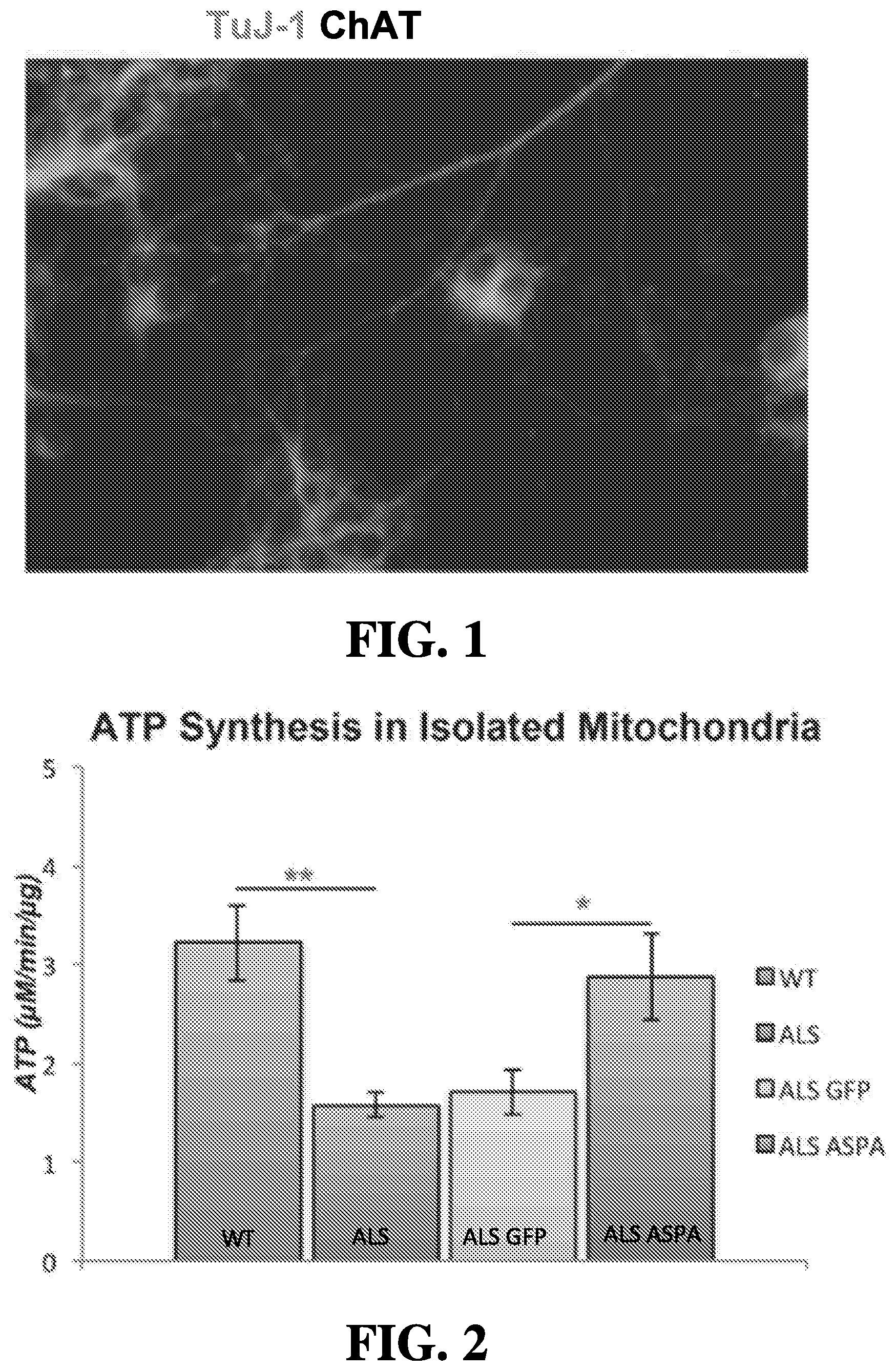 Patent US12508327 — Methods of treating or preventing amyotrophic lateral sclerosis — Figure 1