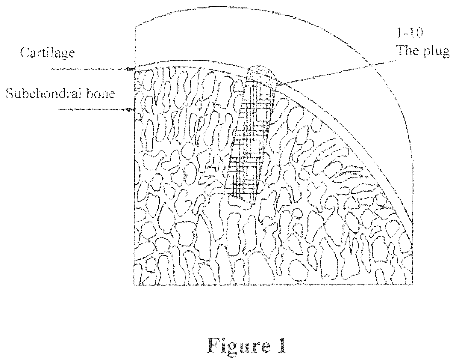 Patent US12508343 — Solid forms for tissue repair — Figure 1