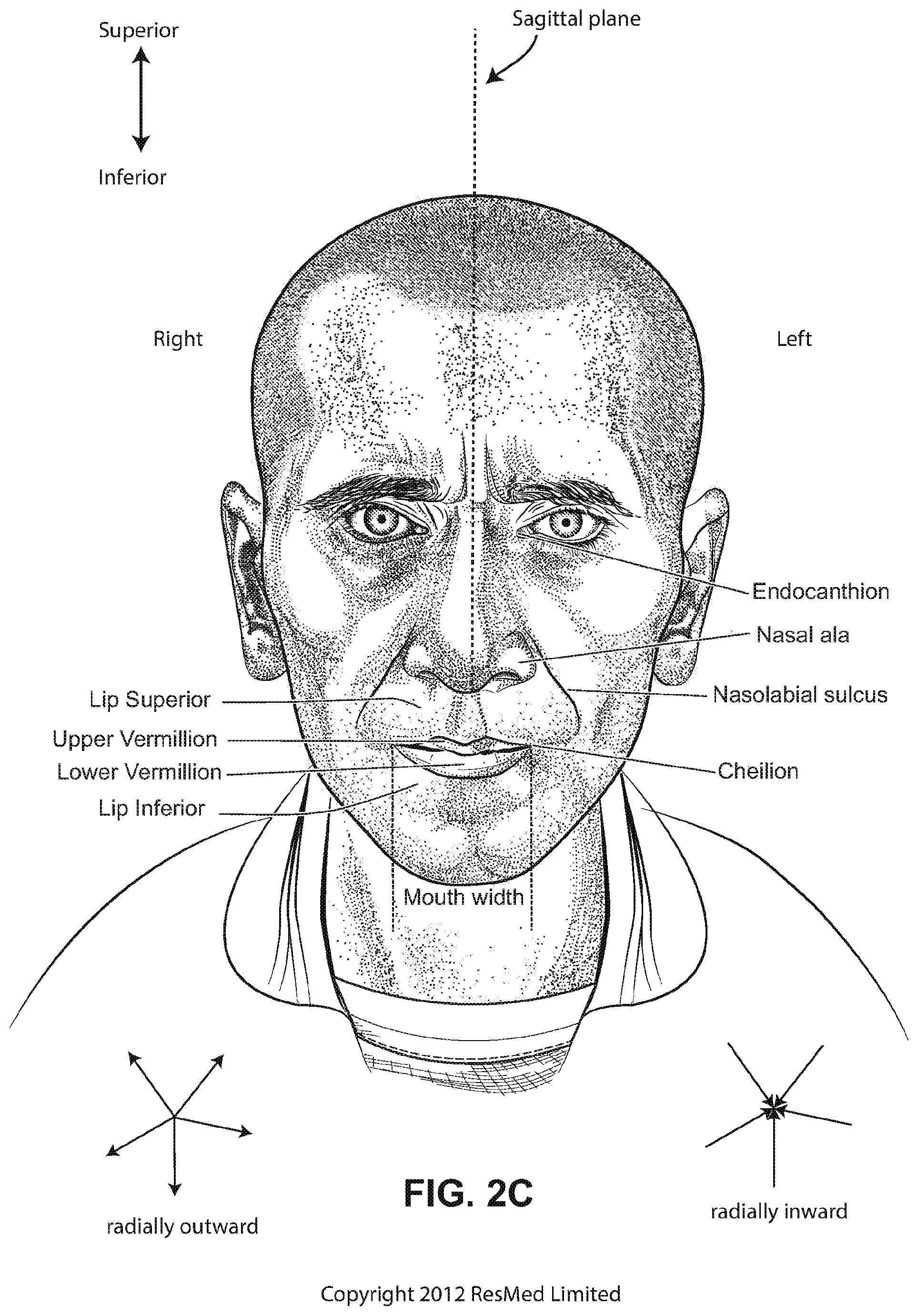 Patent US12508384 Figure 6 – Cushion module for a patient interface