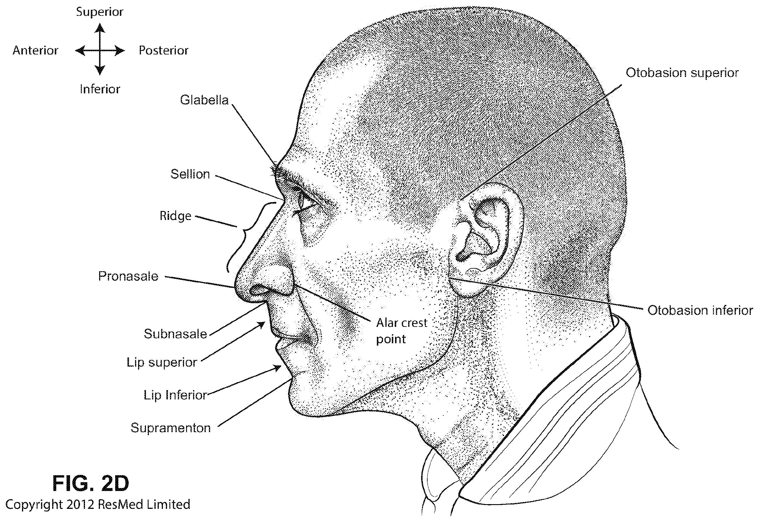 Patent US12508384 Figure 7 – Cushion module for a patient interface