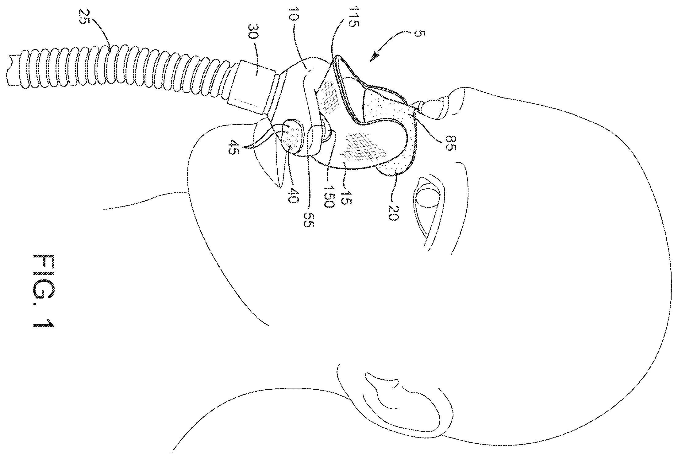Patent US12508387 — Patient interface systems — Figure 1