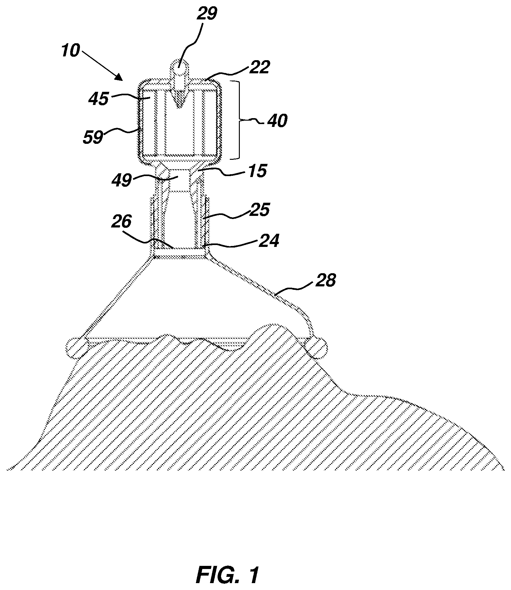 Patent US12508390 Figure 1 – Respiratory fluid flow control device and method of using same