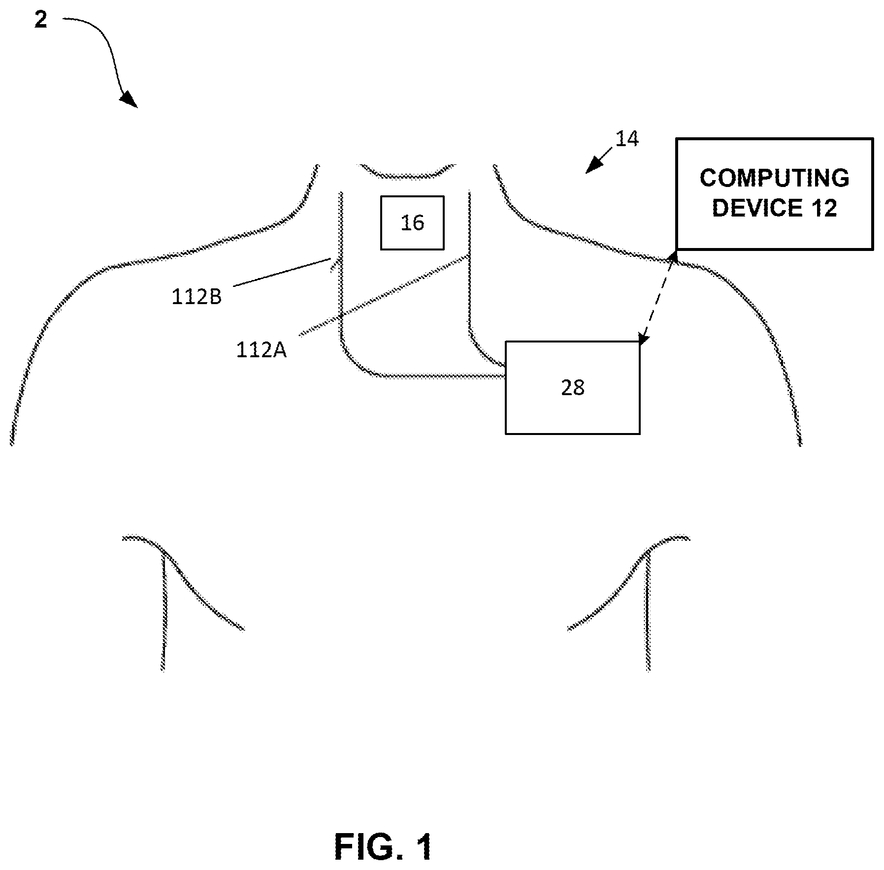 Patent US12508425 Figure 1 – Bilateral vagus nerve stimulation
