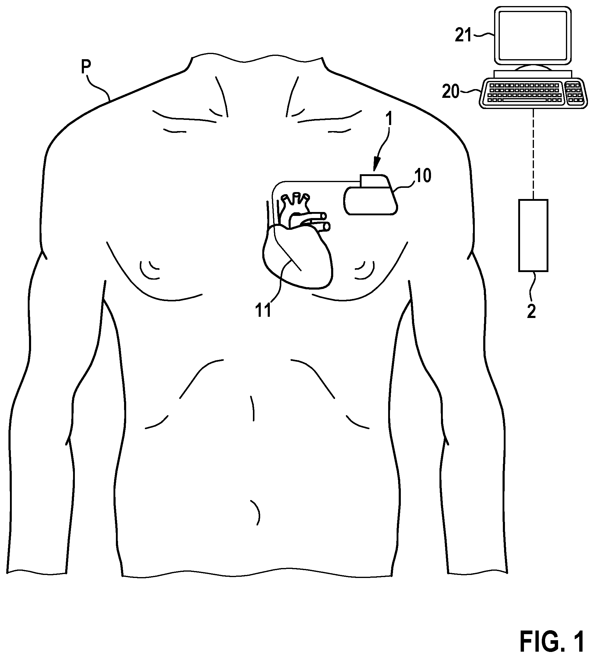 Patent US12508429 — Medical system for performing a therapeutic function on a patient — Figure 1