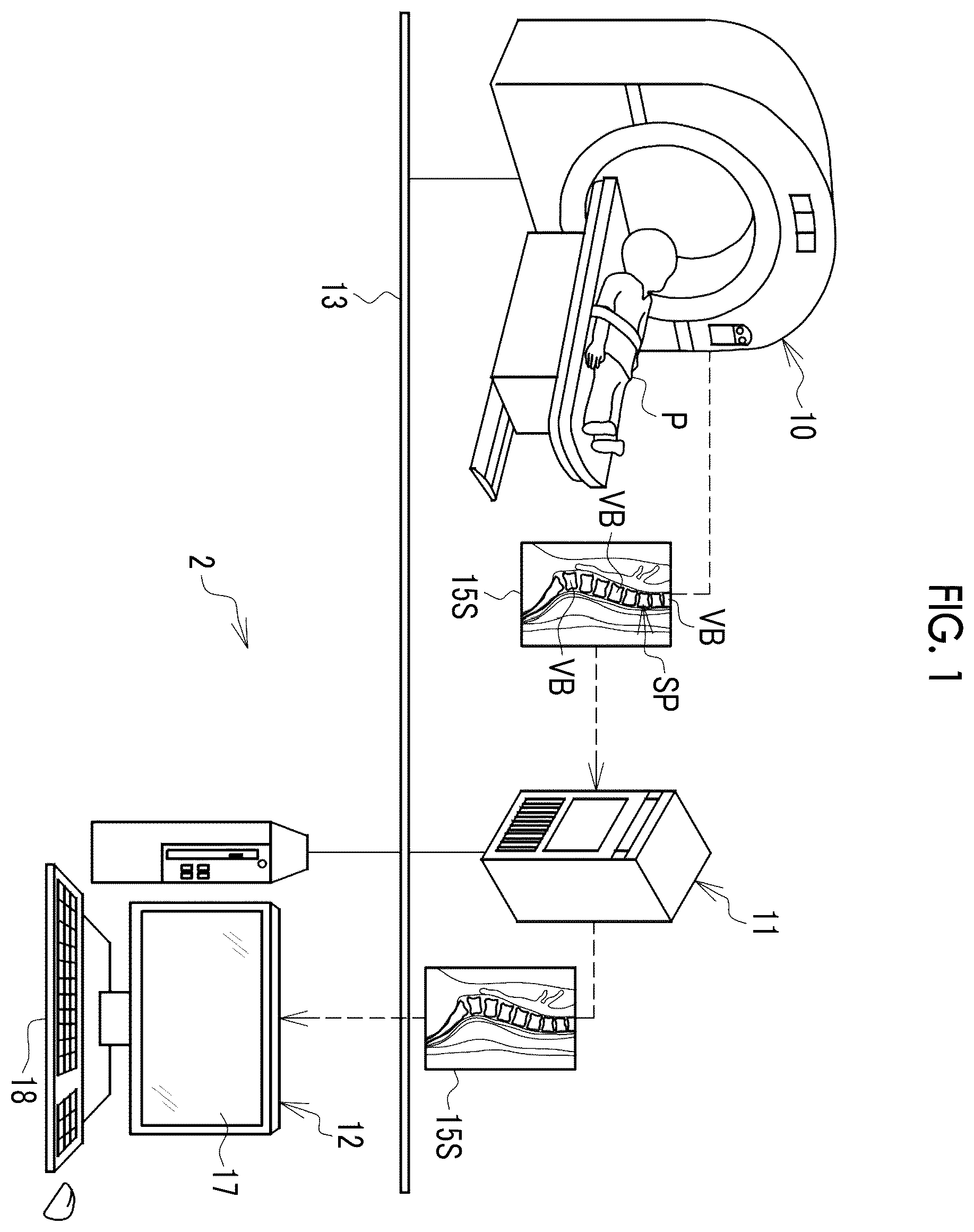 Patent US12511756 Figure 1 – Image processing apparatus, operation method of image processing apparatus, operation program of image processing apparatus, and learning method
