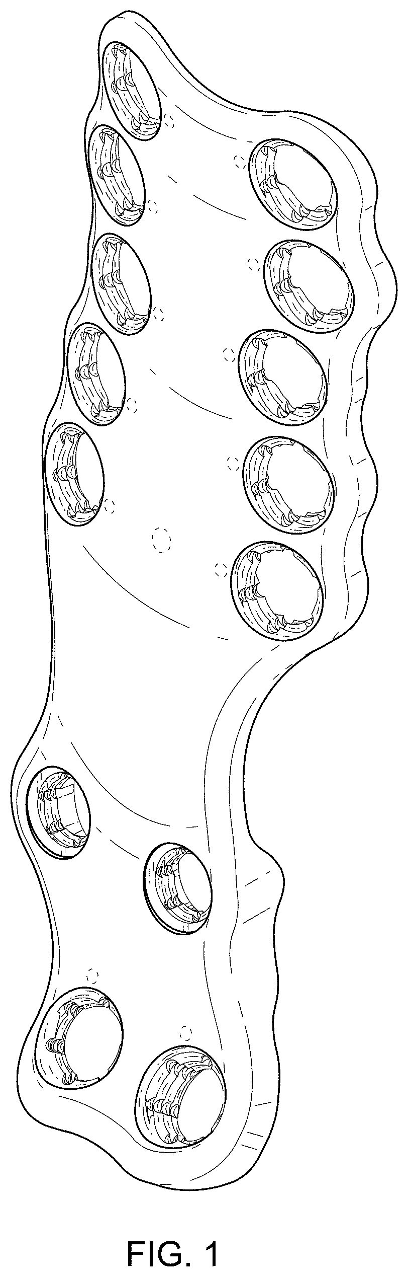 Patent USD1076090 — Straddle bone plate — Figure 1