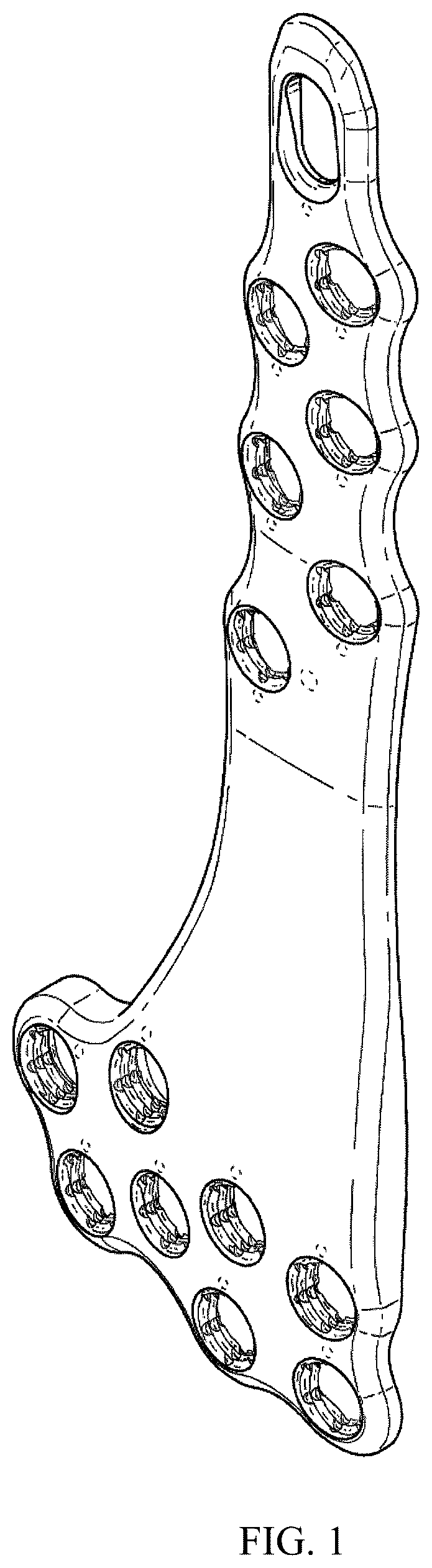 Patent USD1076091 — Straddle bone plate — Figure 1
