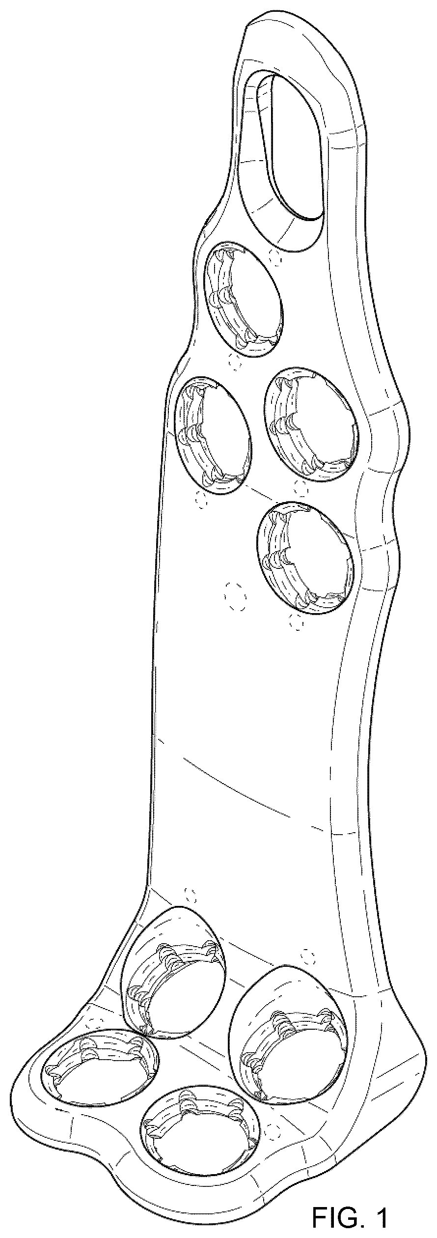 Patent USD1076092 — Span bone plate — Figure 1